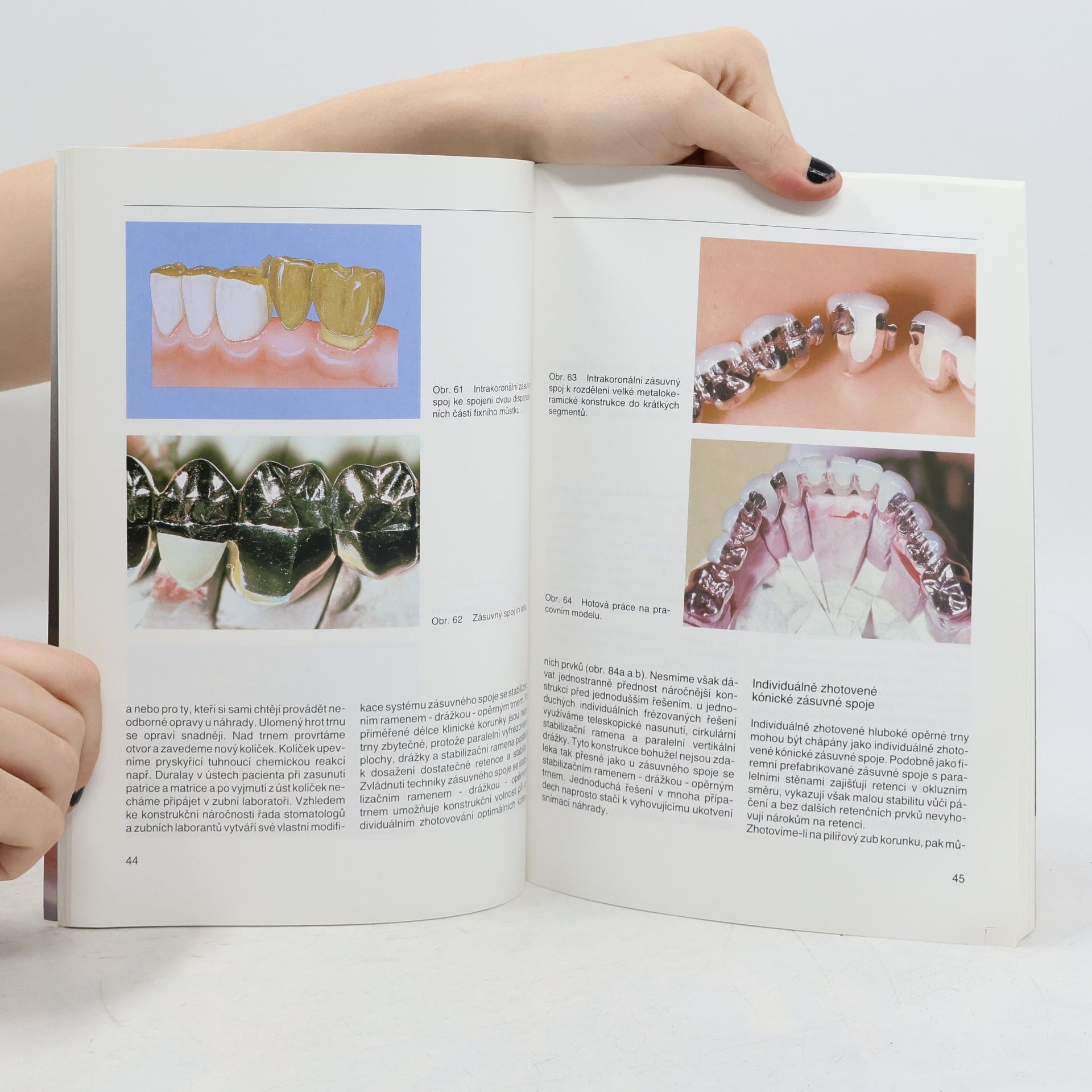 H W Preiskel Quintessenz Bibliothek: Zásuvné spoje v klinické praxi