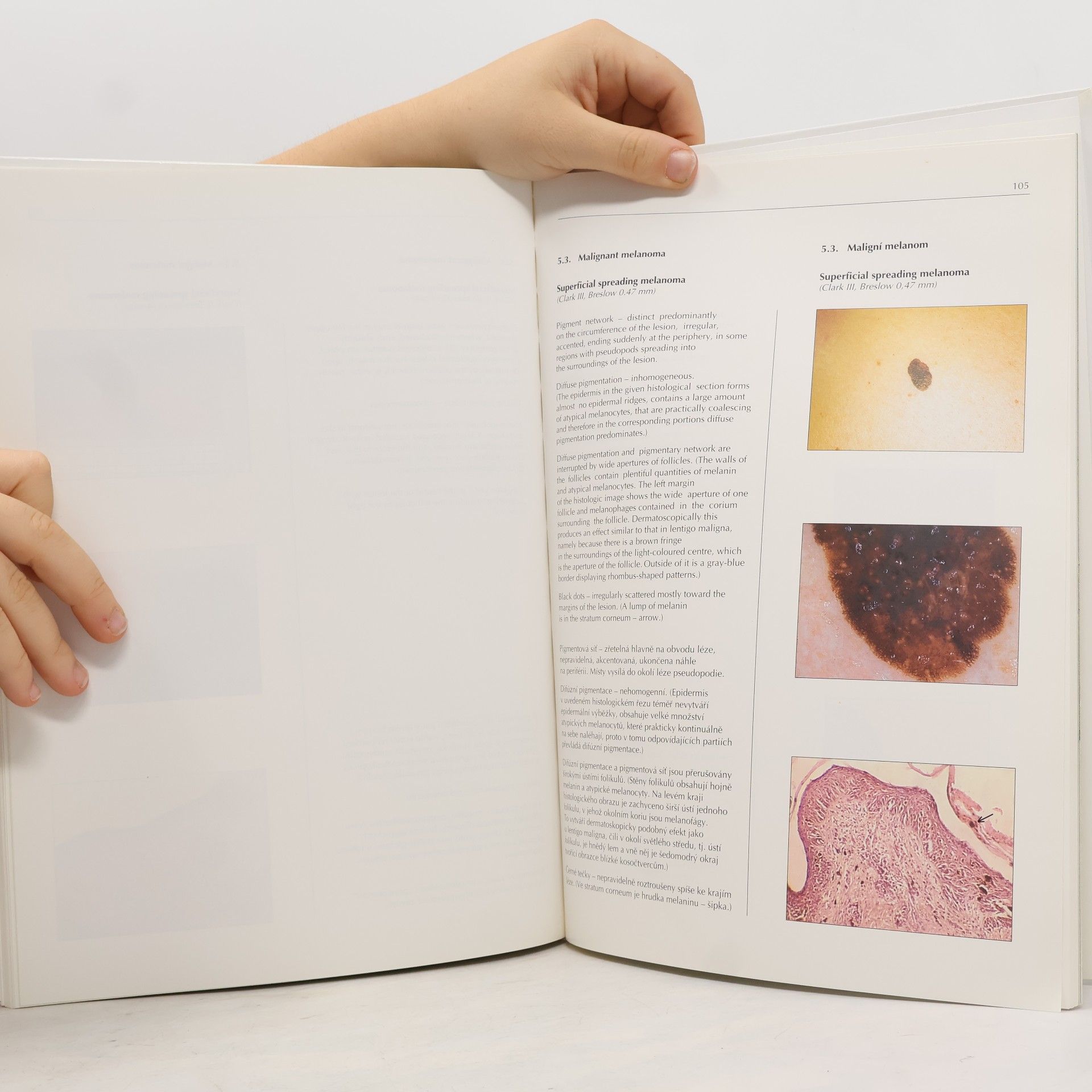Lumír Pock Dermatoskopický atlas