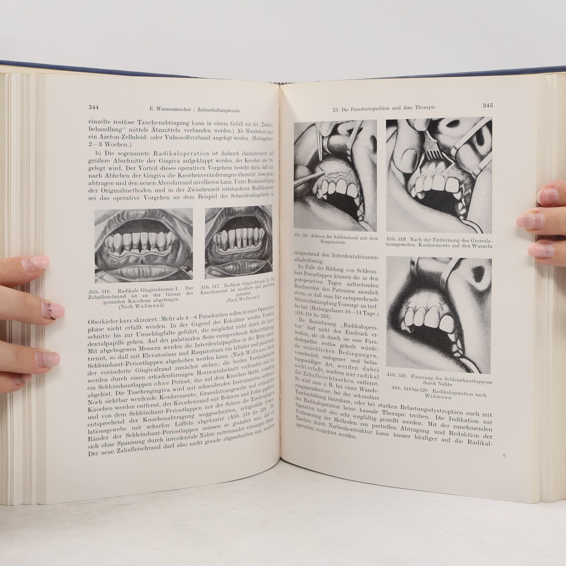 Otto Müller-Hofer Lehrbuch der klinischen Zahnheilkunde Band 2