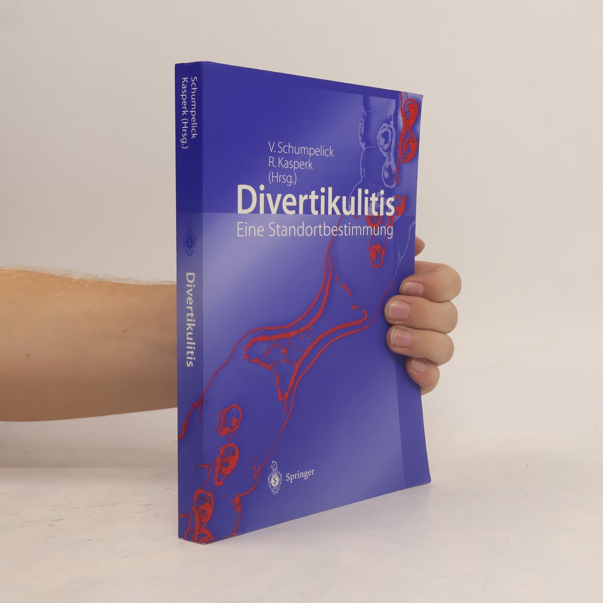 Divertikulitis