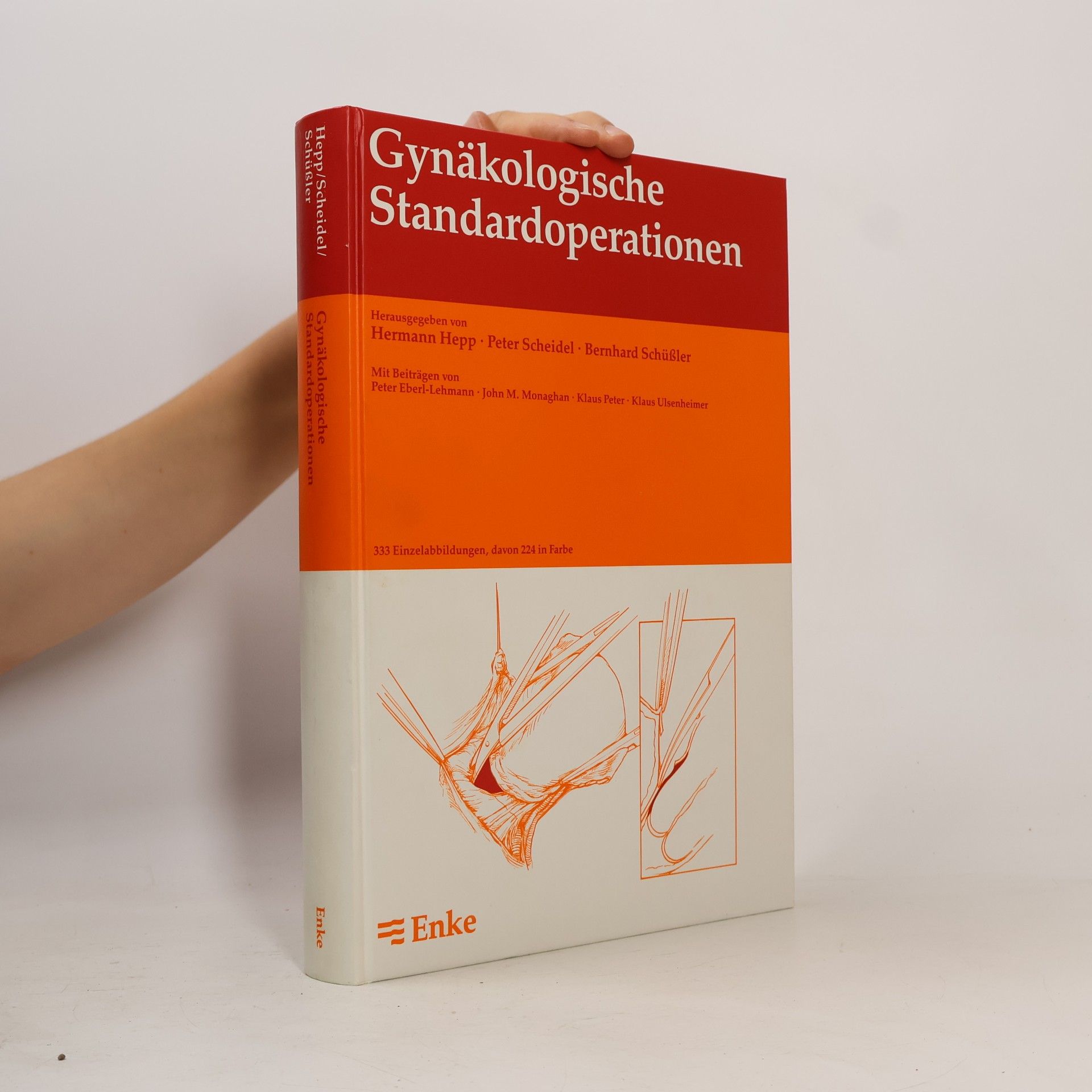 Hermann Hepp Gynäkologische Standardoperationen