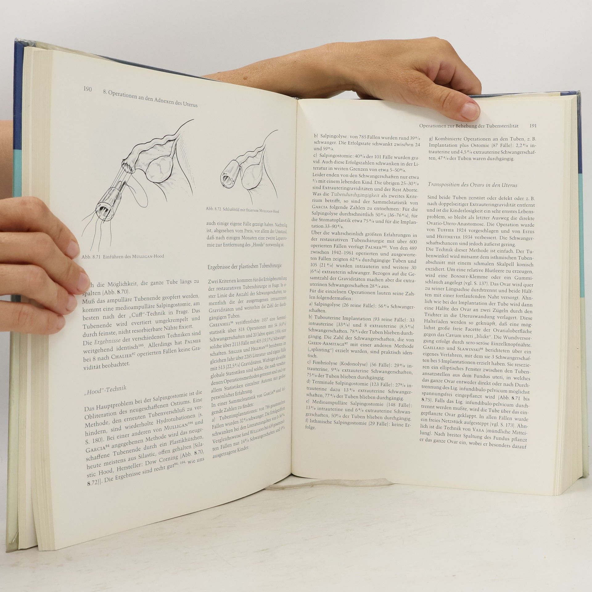 Otto Käser Atlas der gynäkologischen Operationen