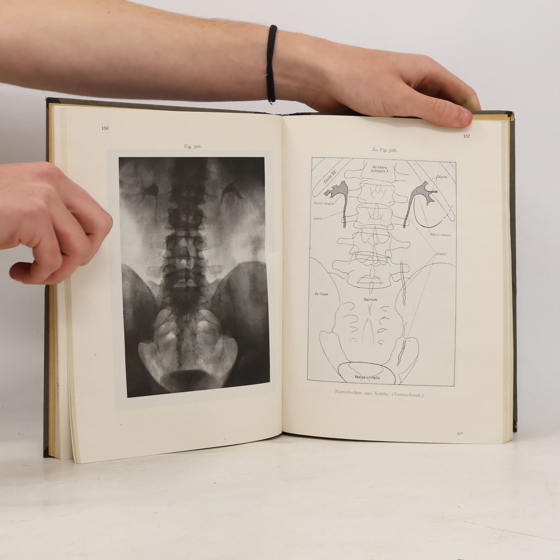 Autores varios Toldtův Anatomický atlas pro studující a lékaře 2. díl