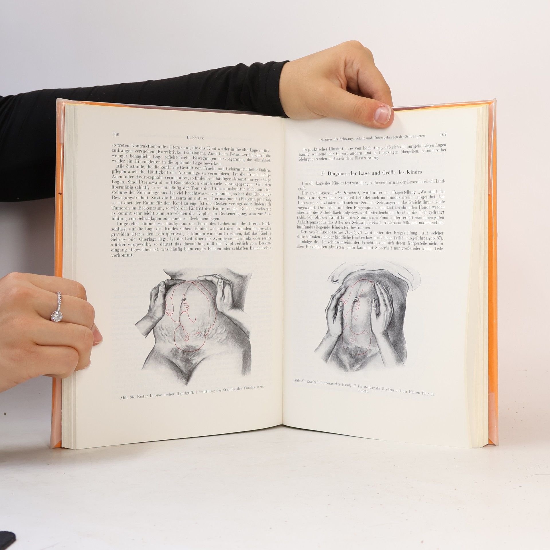 Walter Stoeckel Lehrbuch der Geburtshilfe Teil. I