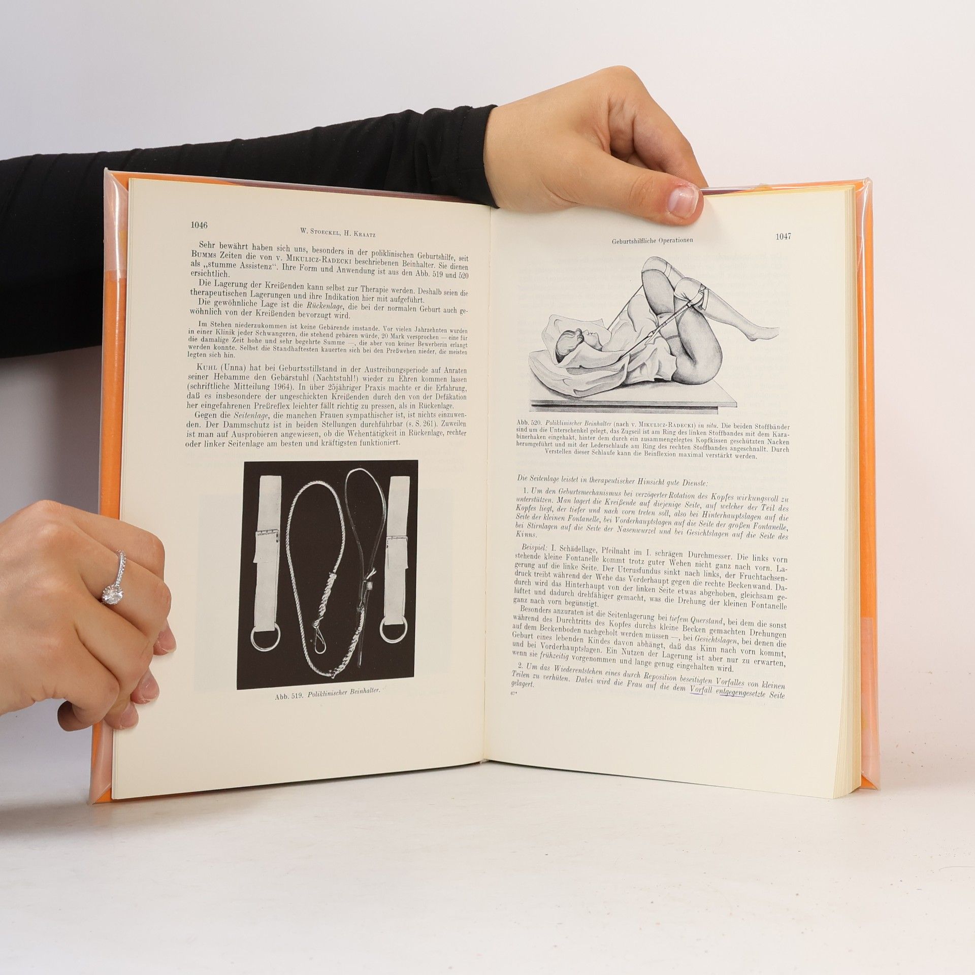 Walter Stoeckel Stoeckels Lehrbuch der Geburtshilfe. Teil III