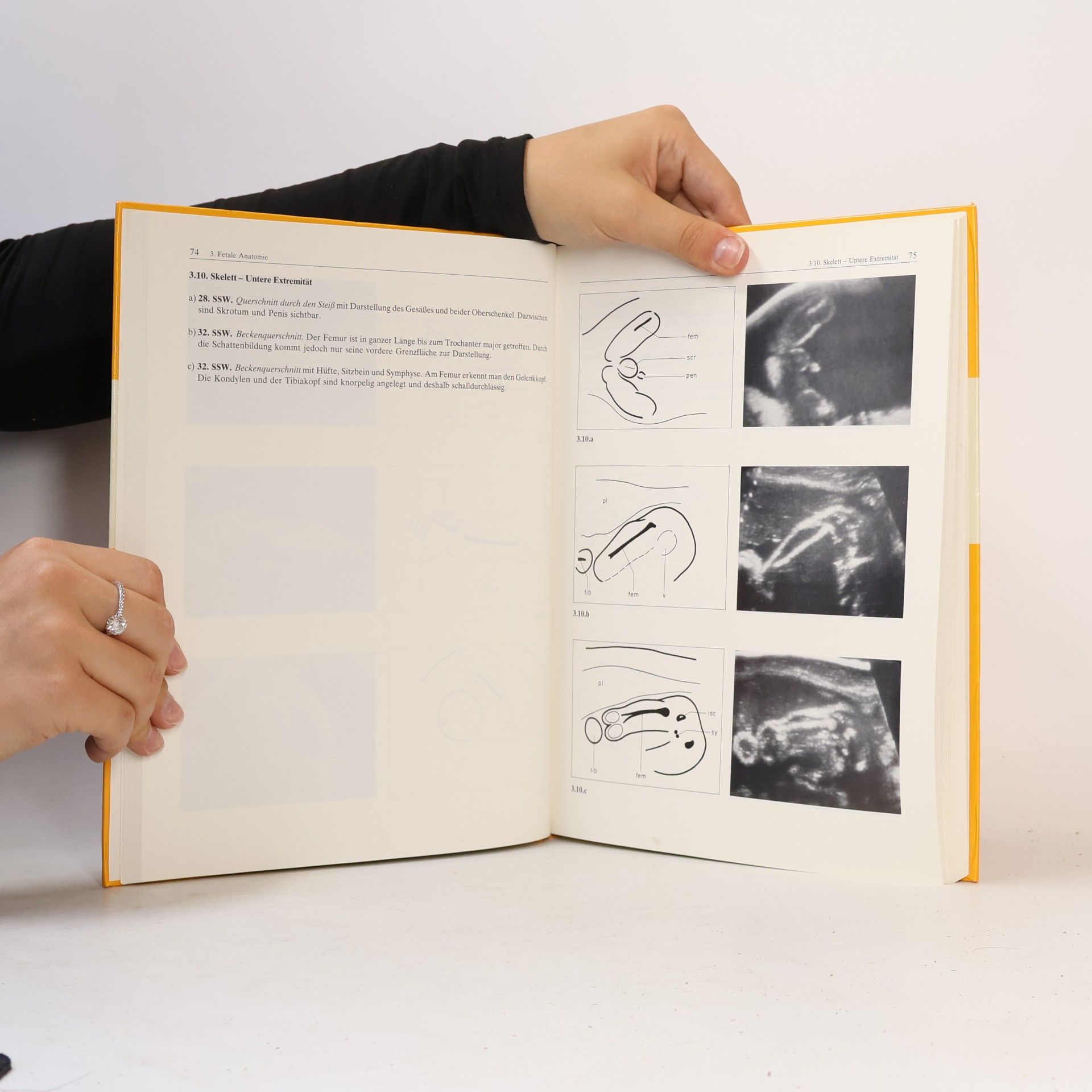 Helmut Schillinger Atlas der Ultraschalldiagnostik in der Schwangerschaft