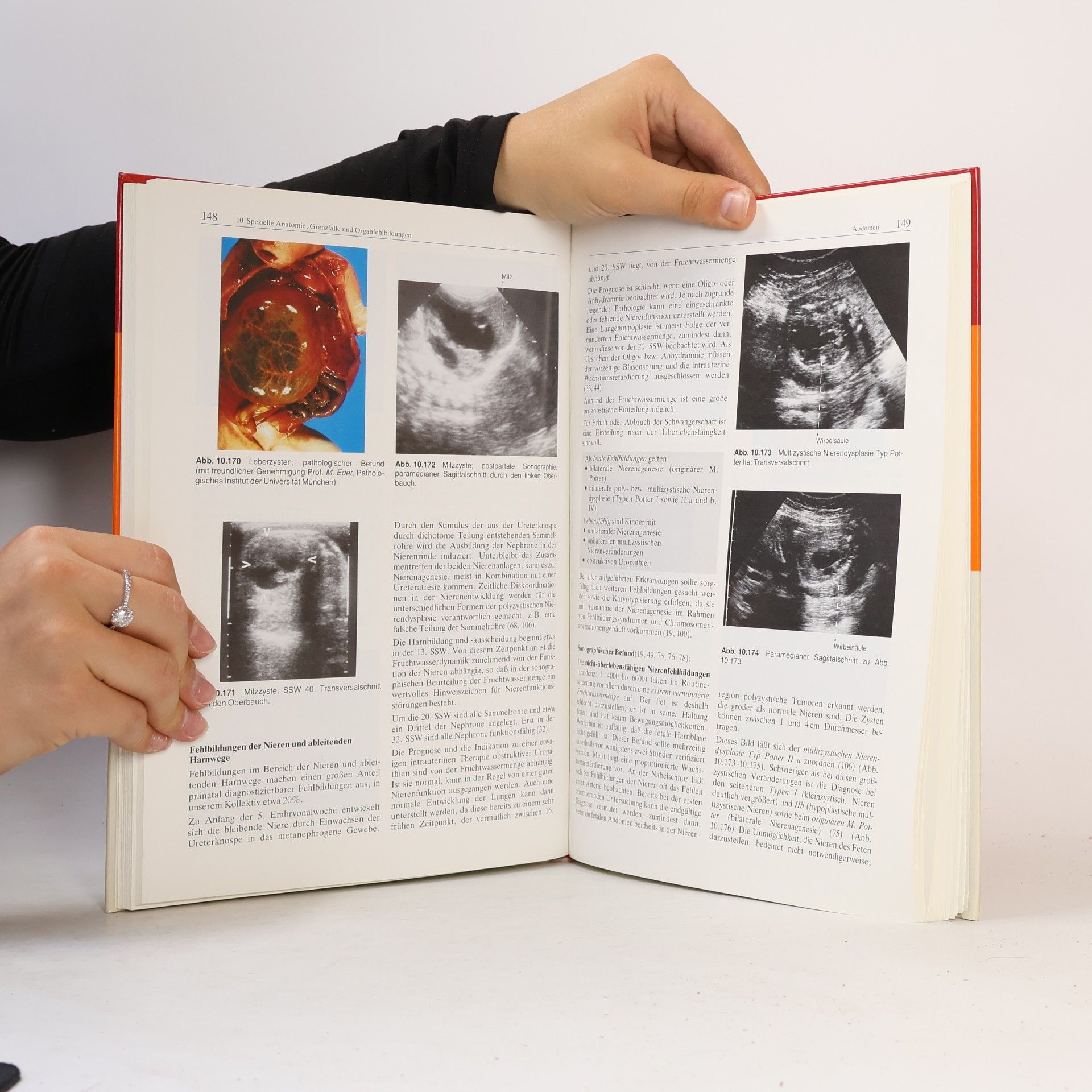Thomas Schramm Pränatale und gynäkologische Sonographie
