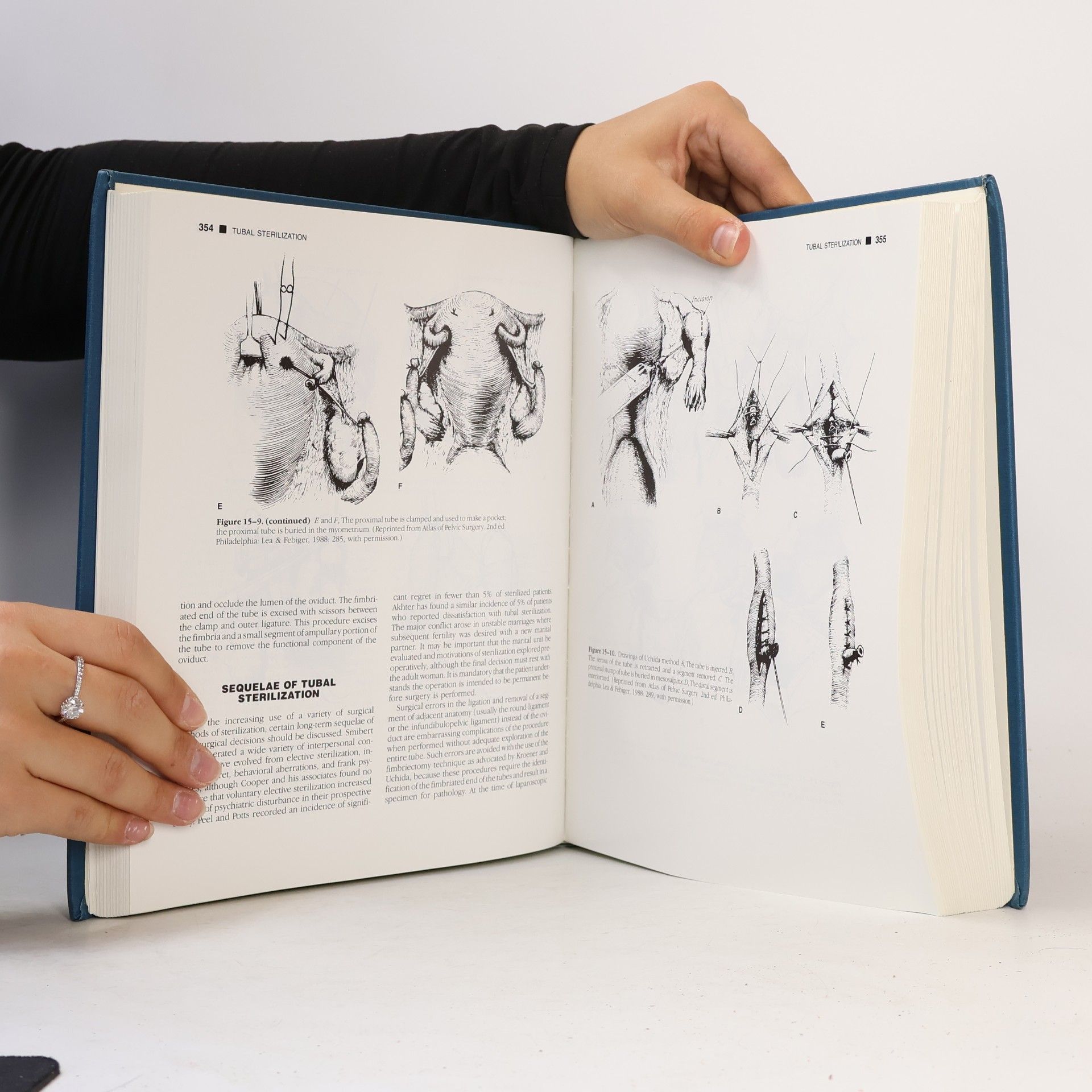 John Daniel Thompson Te Linde's Operative Gynecology