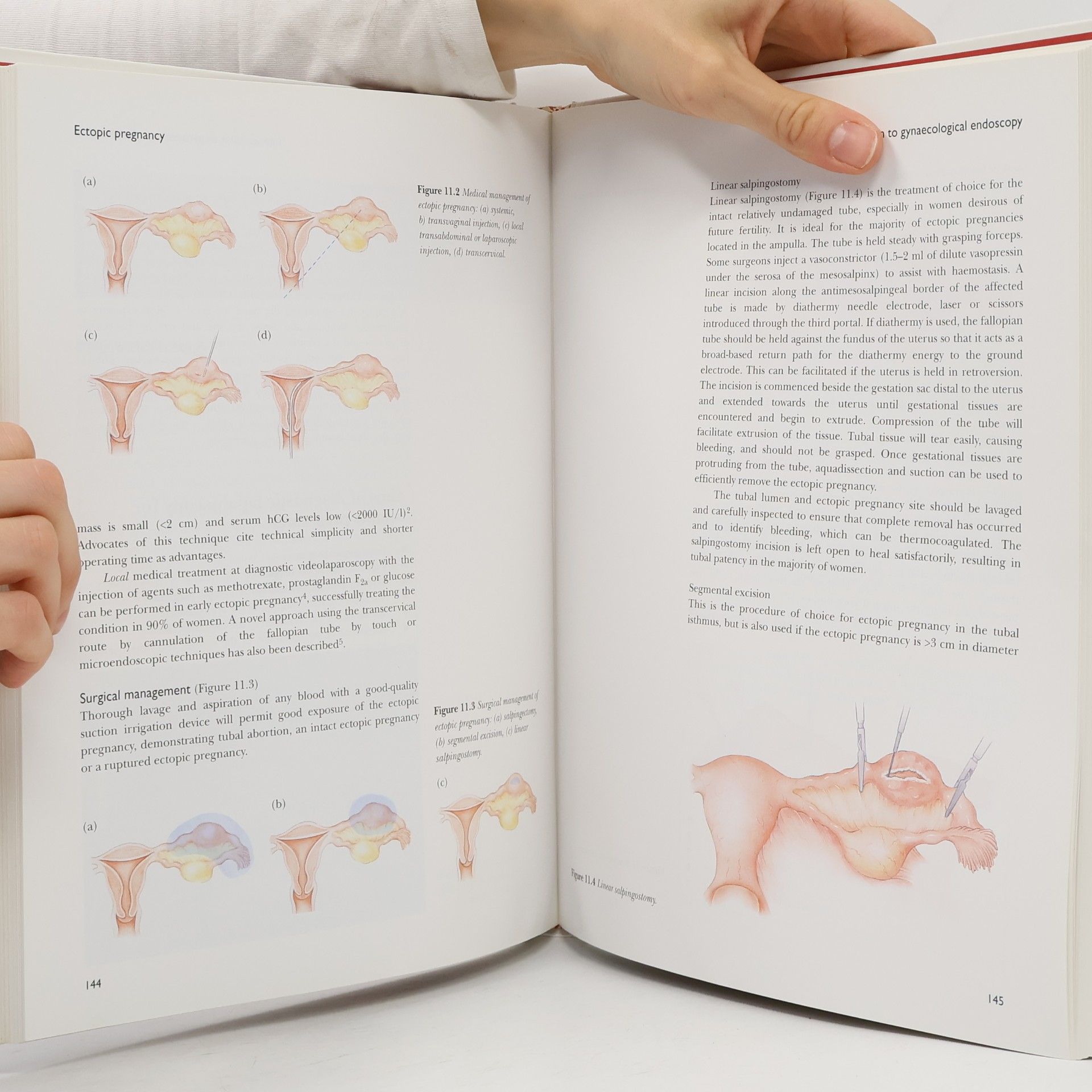 Adrian M. Lower Introduction to Gynecological Endoscopy