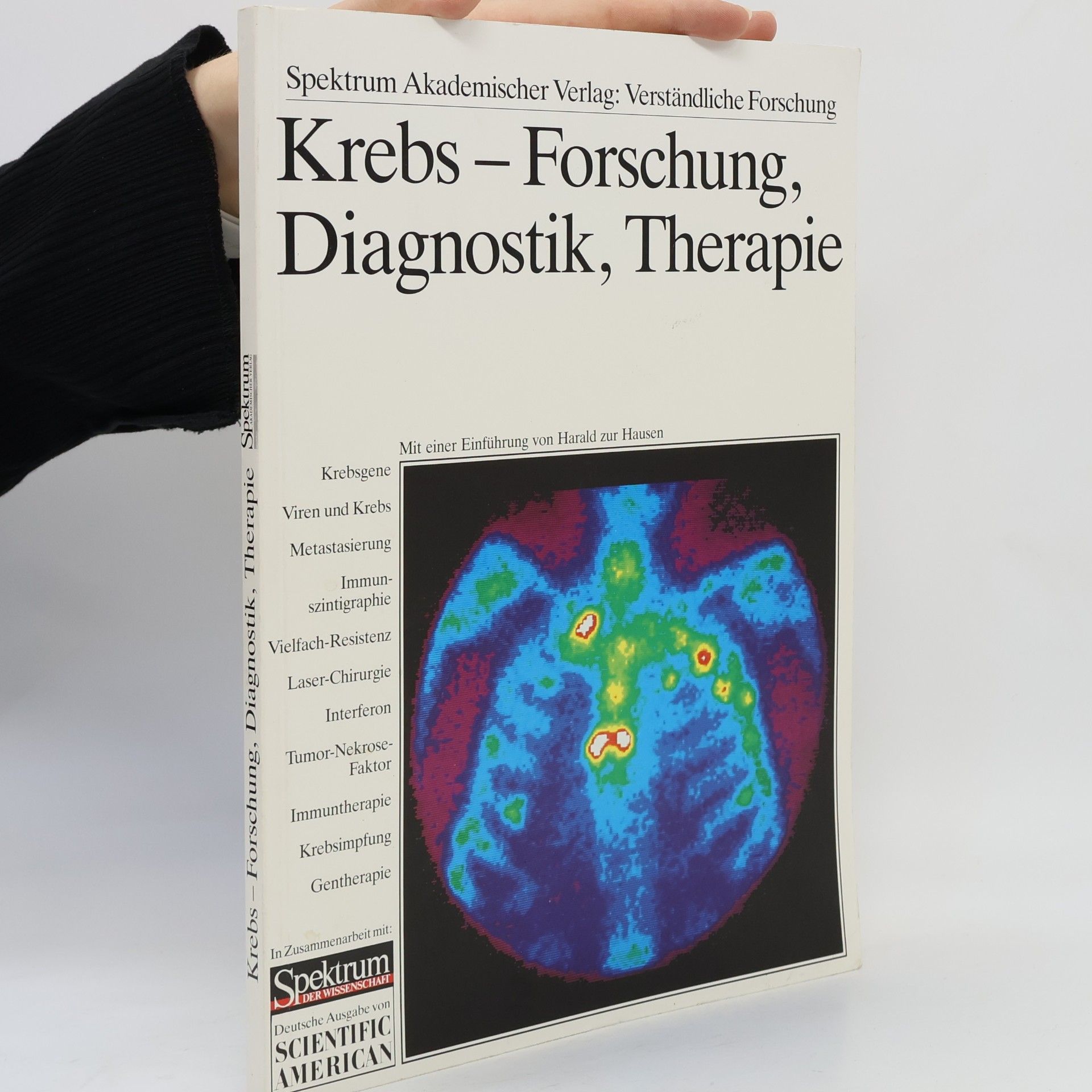Autores varios Krebs