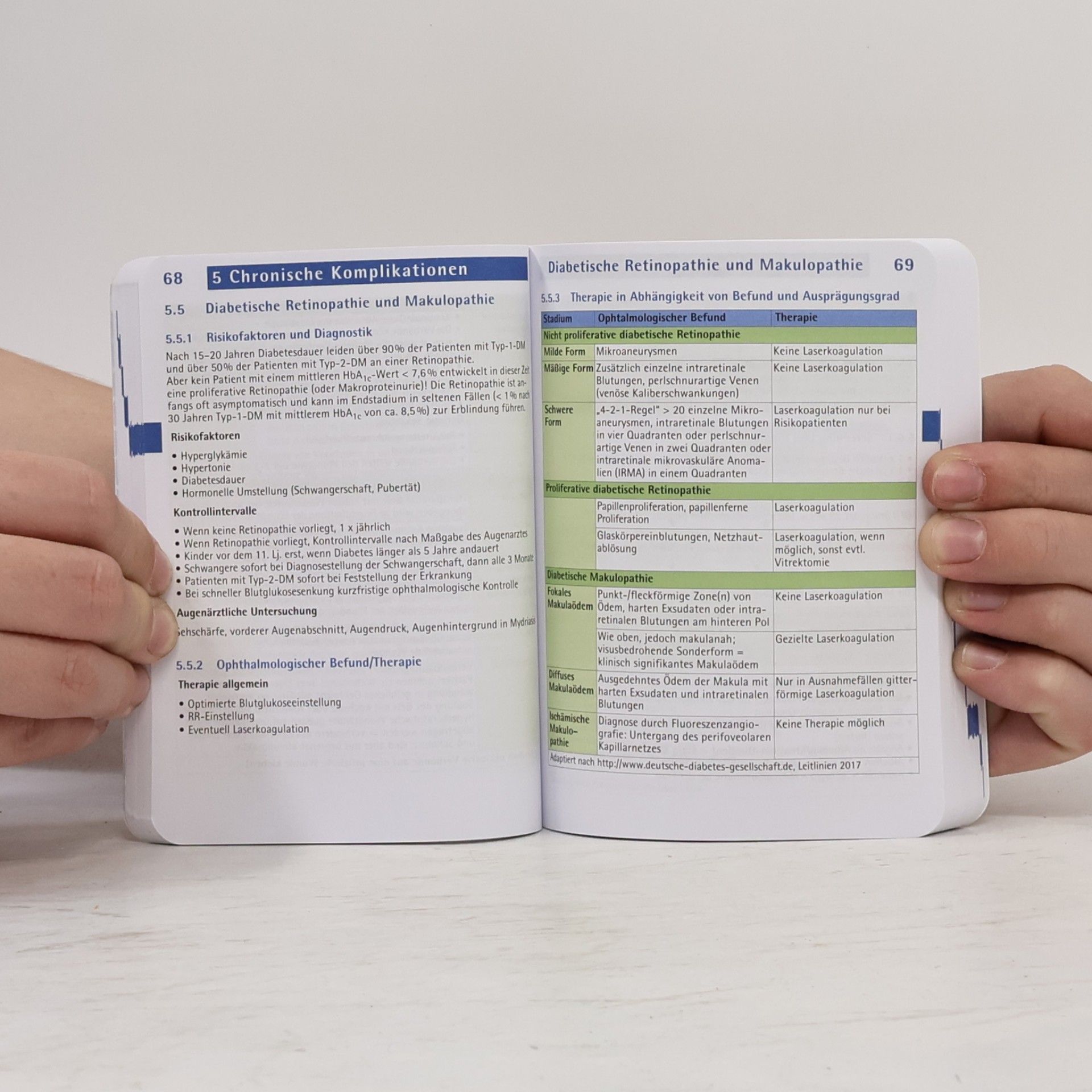 Erhard Siegel Diabetes mellitus pocket - 9. Auflage