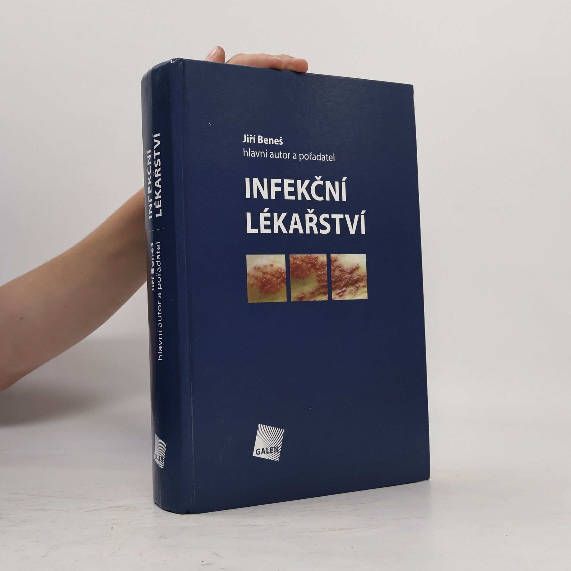 Jiří Beneš Infekční lékařství