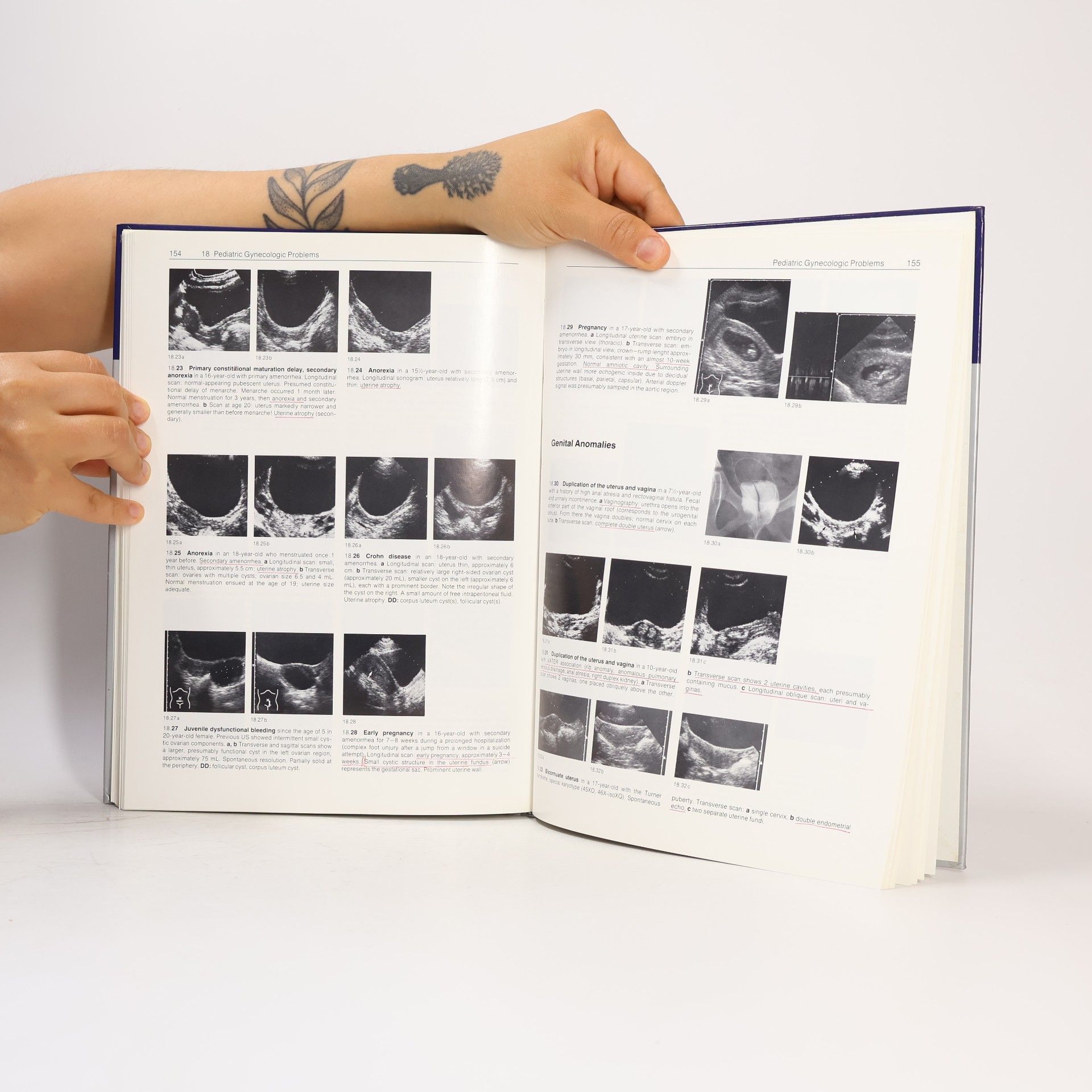 Reinhard D. Schulz Atlas of Pediatric Ultrasound
