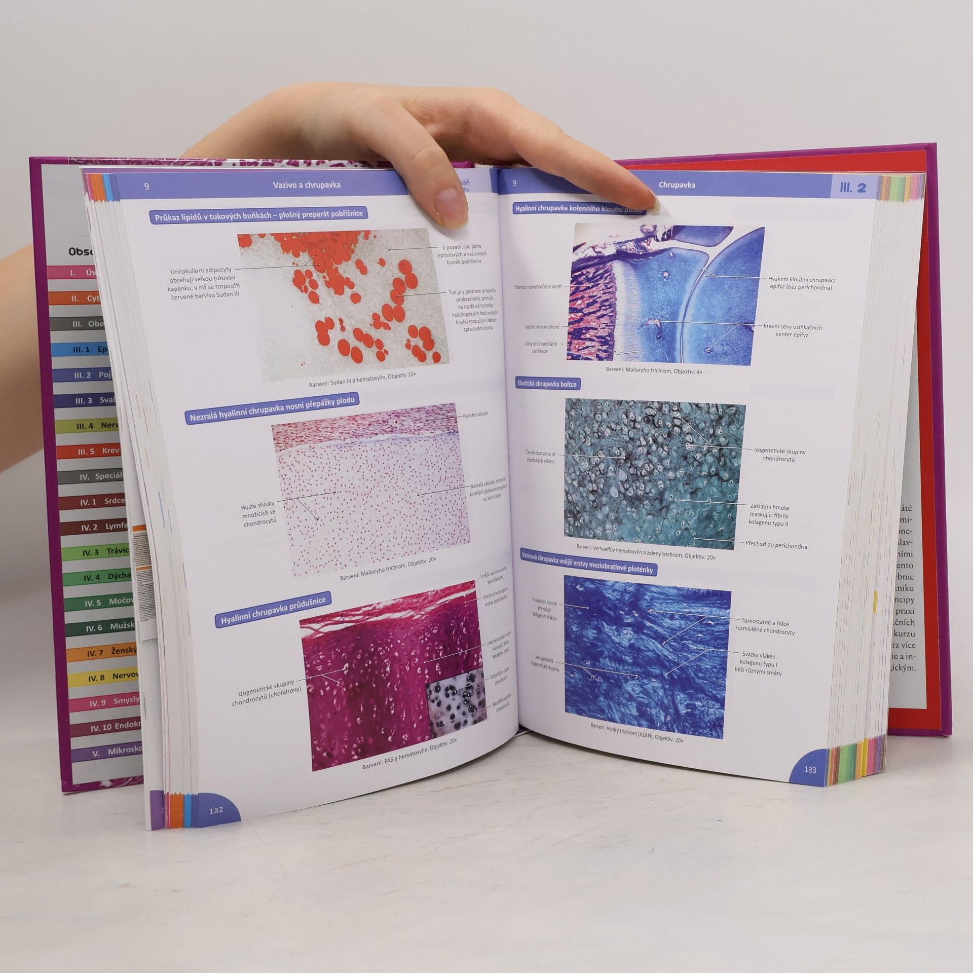 Ivan Varga Memorix histologie