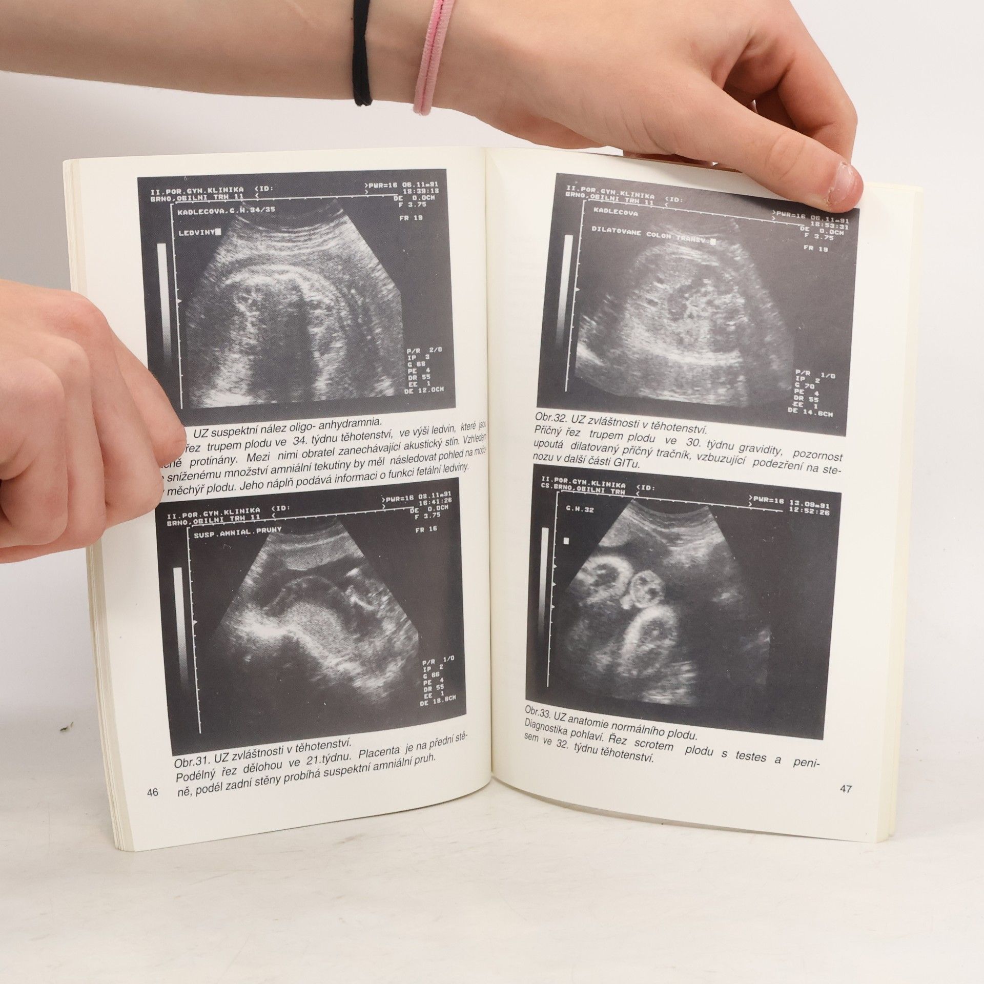 Zdeněk Malý Úvod do ultrazvukové diagnostiky v porodnictví a gynekologii