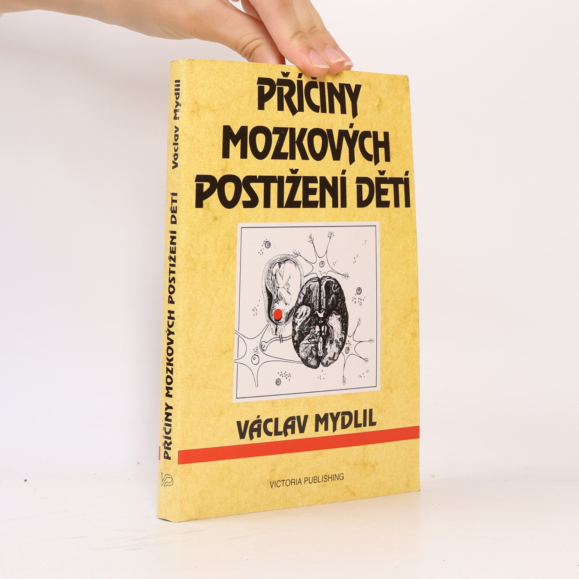 Václav Mydlil Příčiny mozkových postižení dětí