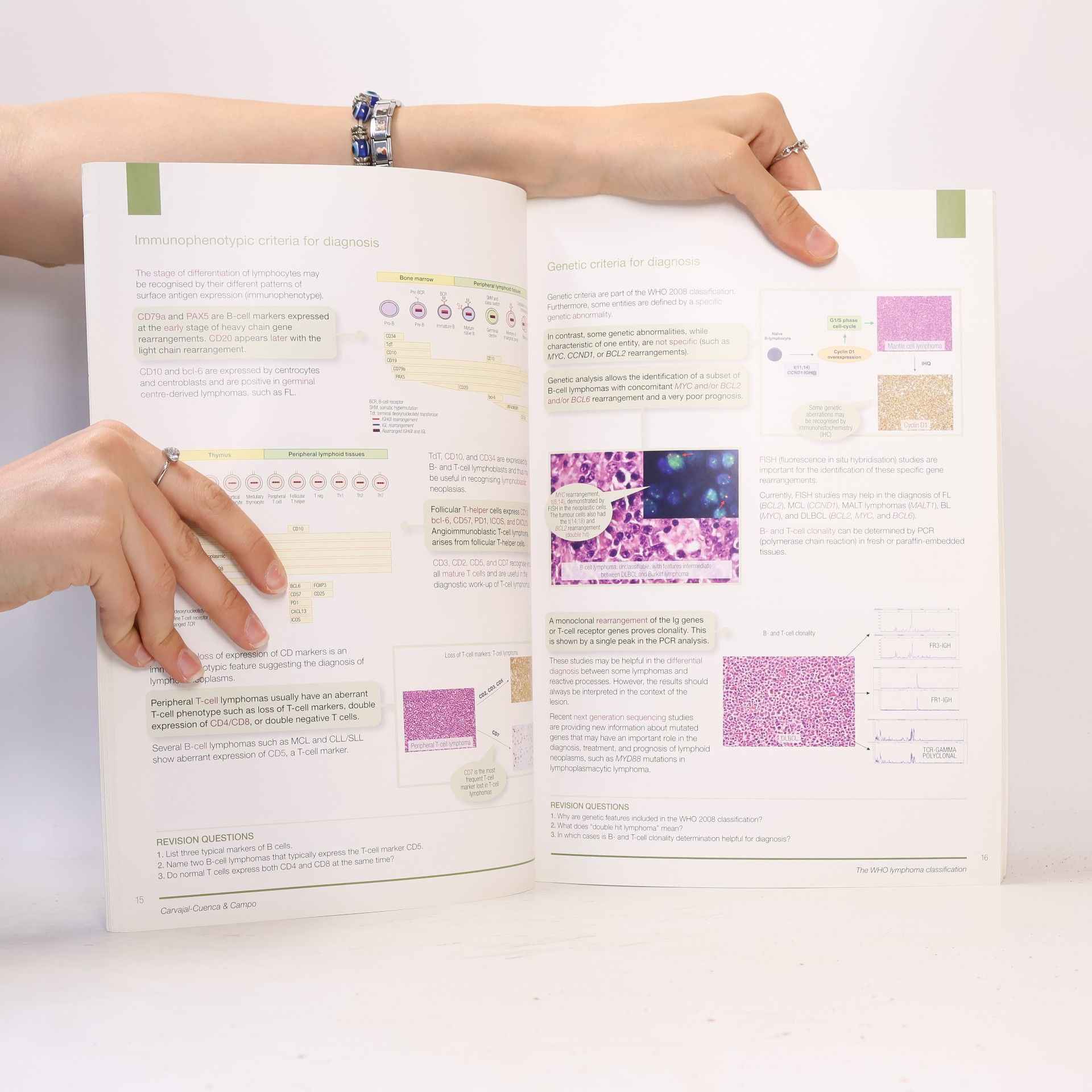 Silvia Montoto Lymphomas
