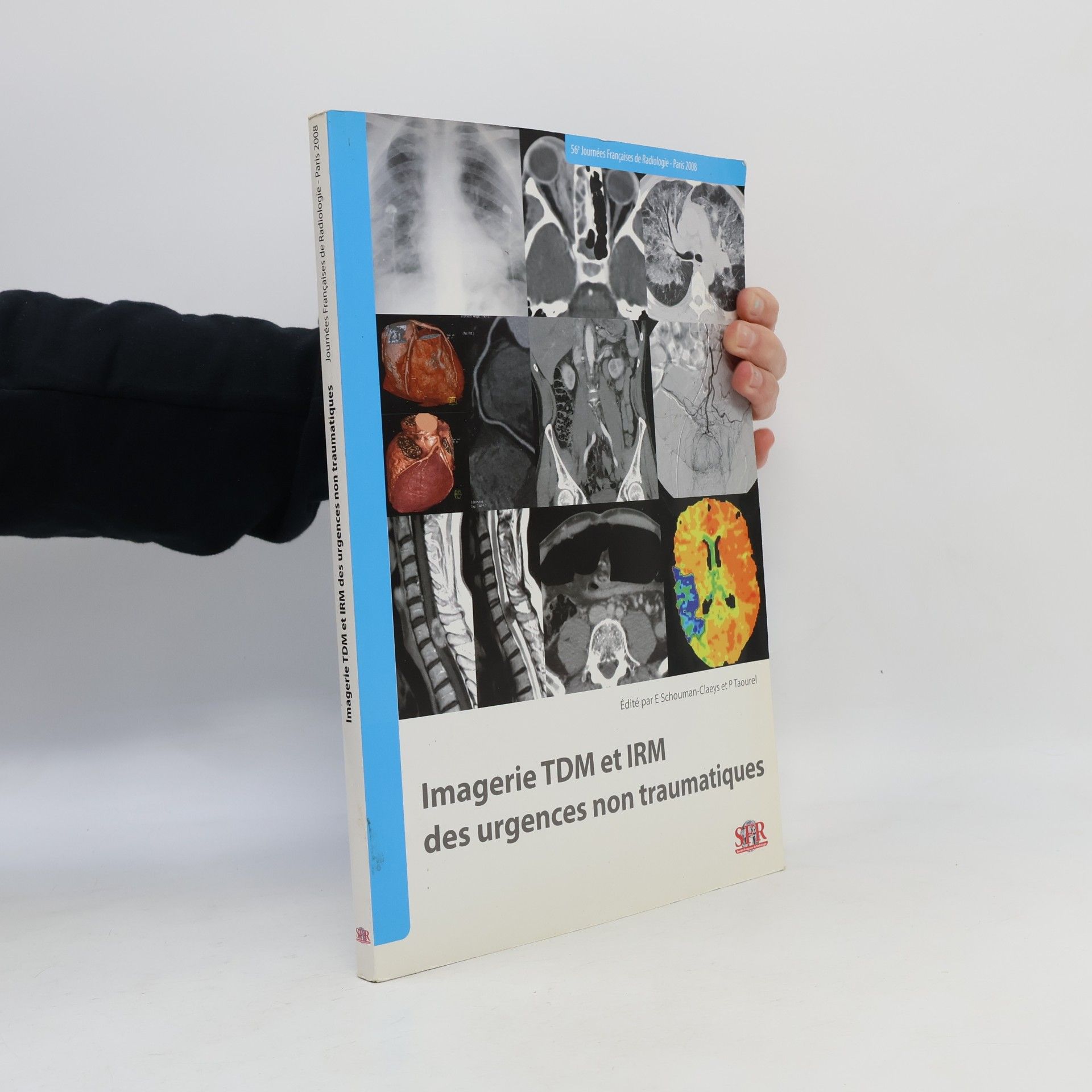 P. Taourel Imagerie TDM et IRM des urgences non traumatiques