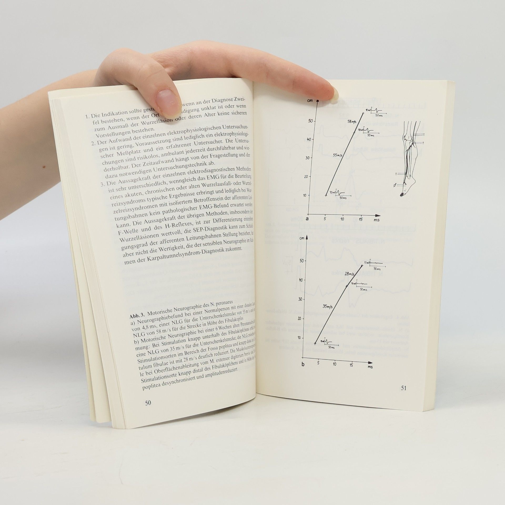 R. Fahlbusch Die lumbale Bandscheibenerkrankung in der ärztlichen Sprechstunde (Kliniktaschenbücher)