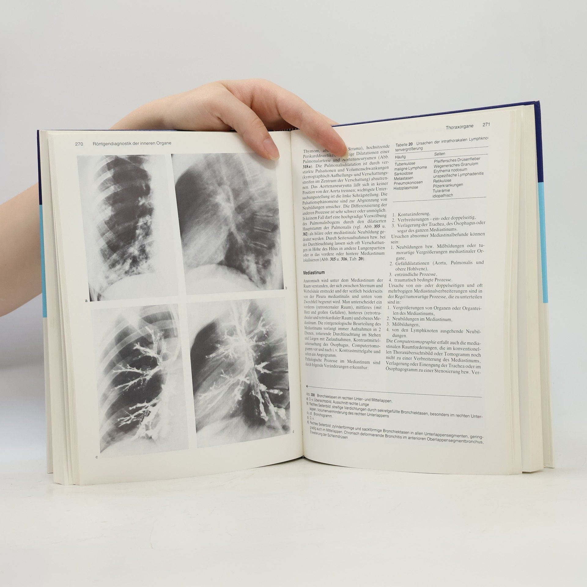 Peter Thurn Einführung in die radiologische Diagnostik