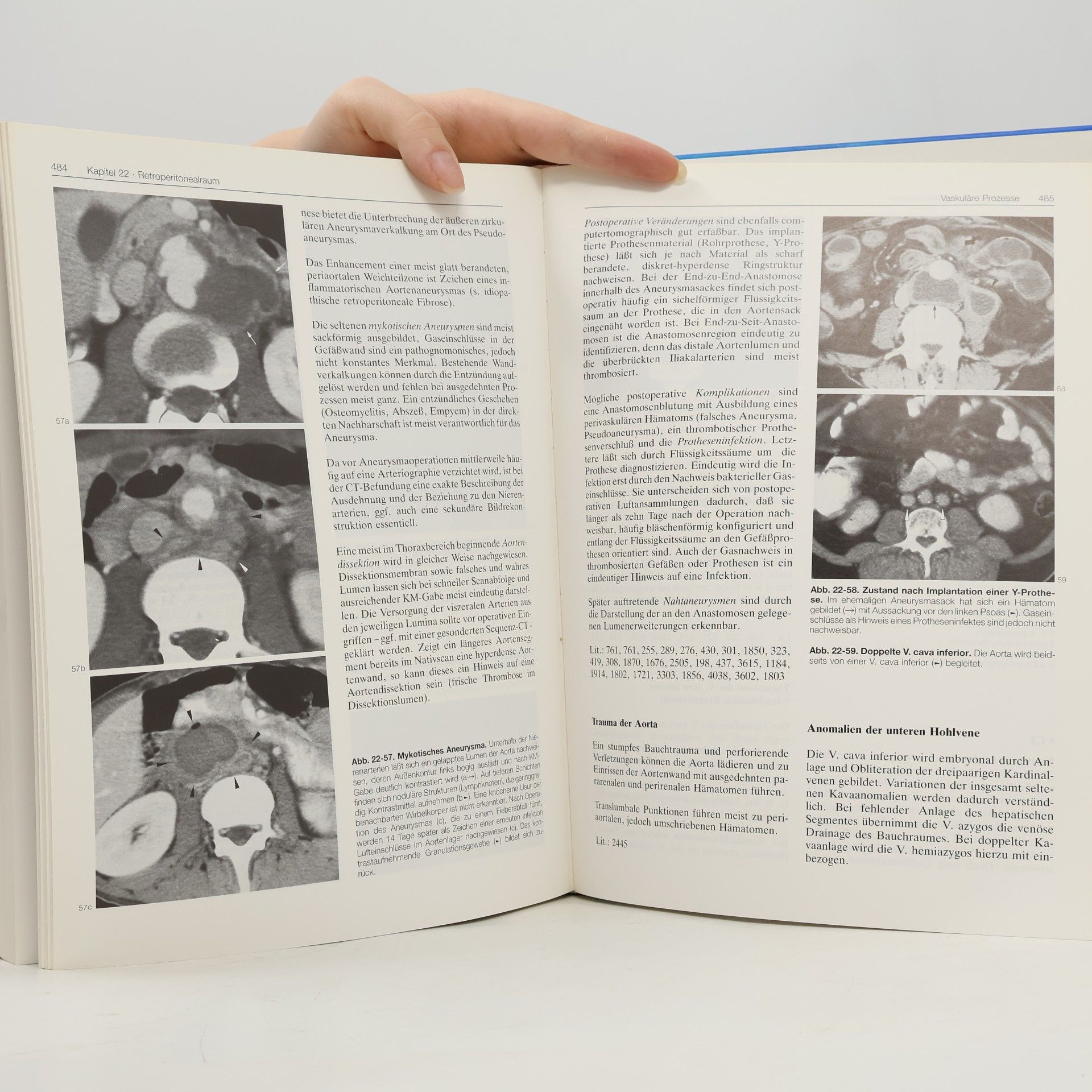 Otto Henning Wegener Ganzkörpercomputertomographie