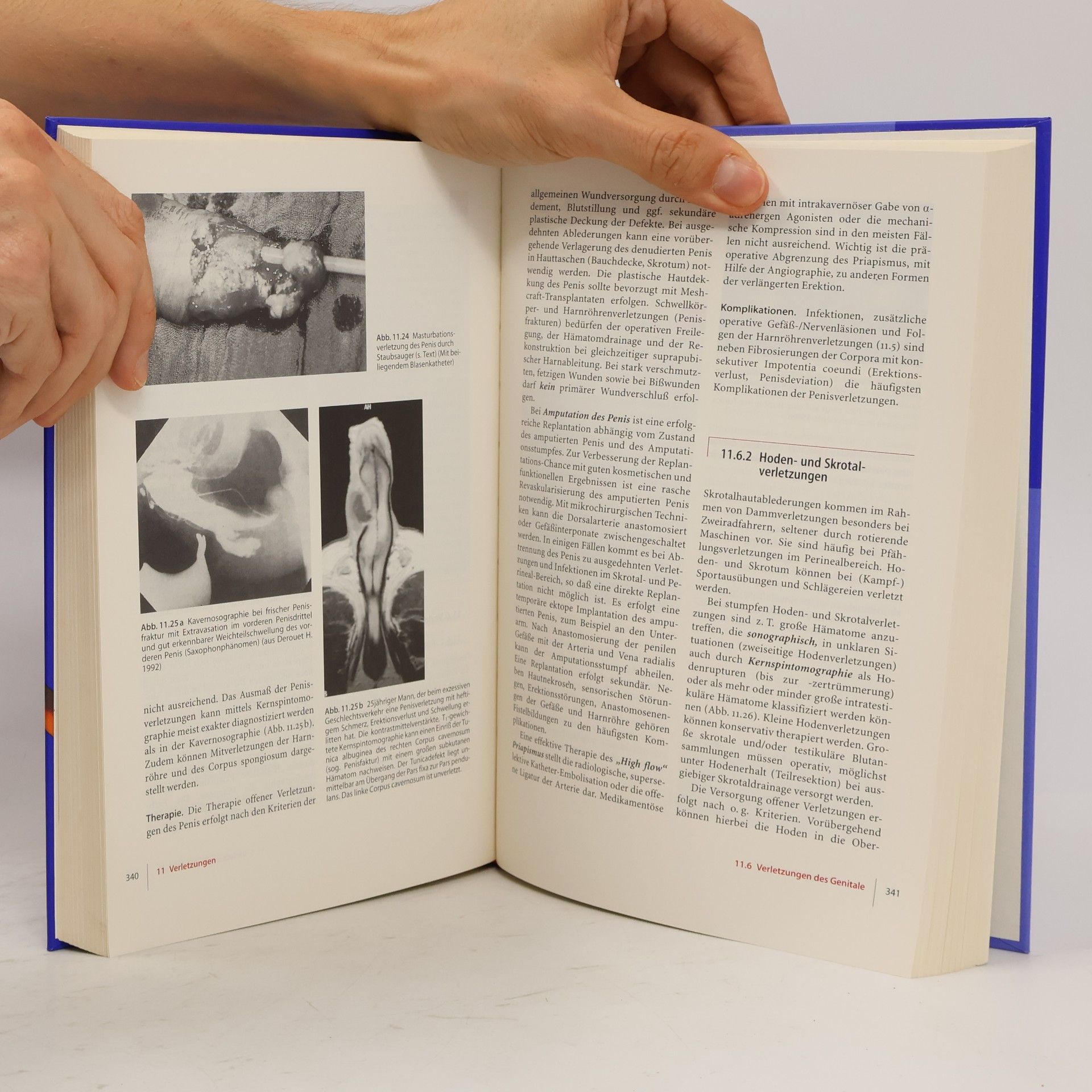 Hartwig Huland Urologie (Springer-Lehrbuch) - 2. Auflage