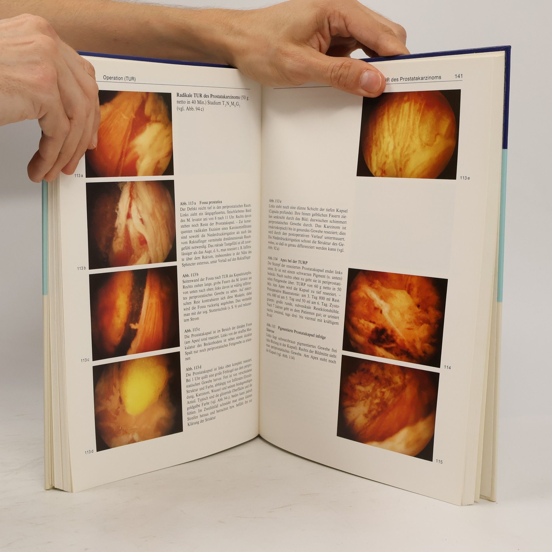 Hans Joachim Reuter Atlas der urologischen Endoskopie
