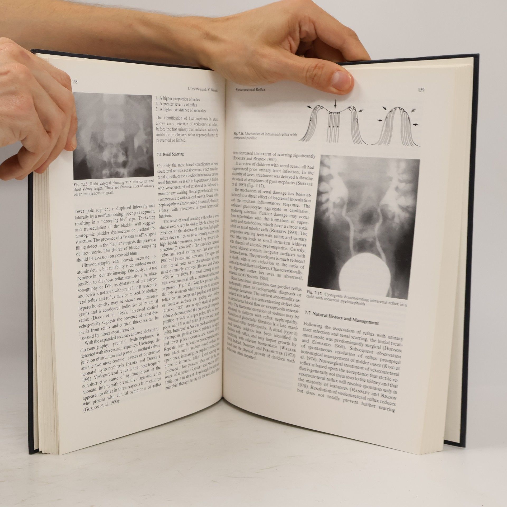 Erich Karl Lang Radiology of the Lower Urinary Tract