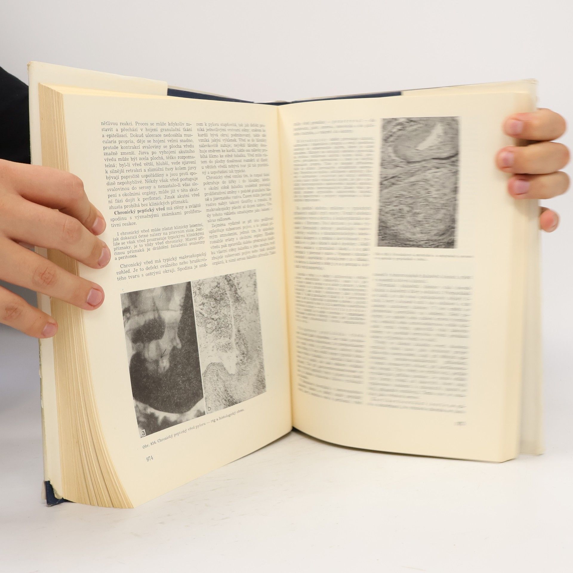Blahoslav Bednář Patologie II