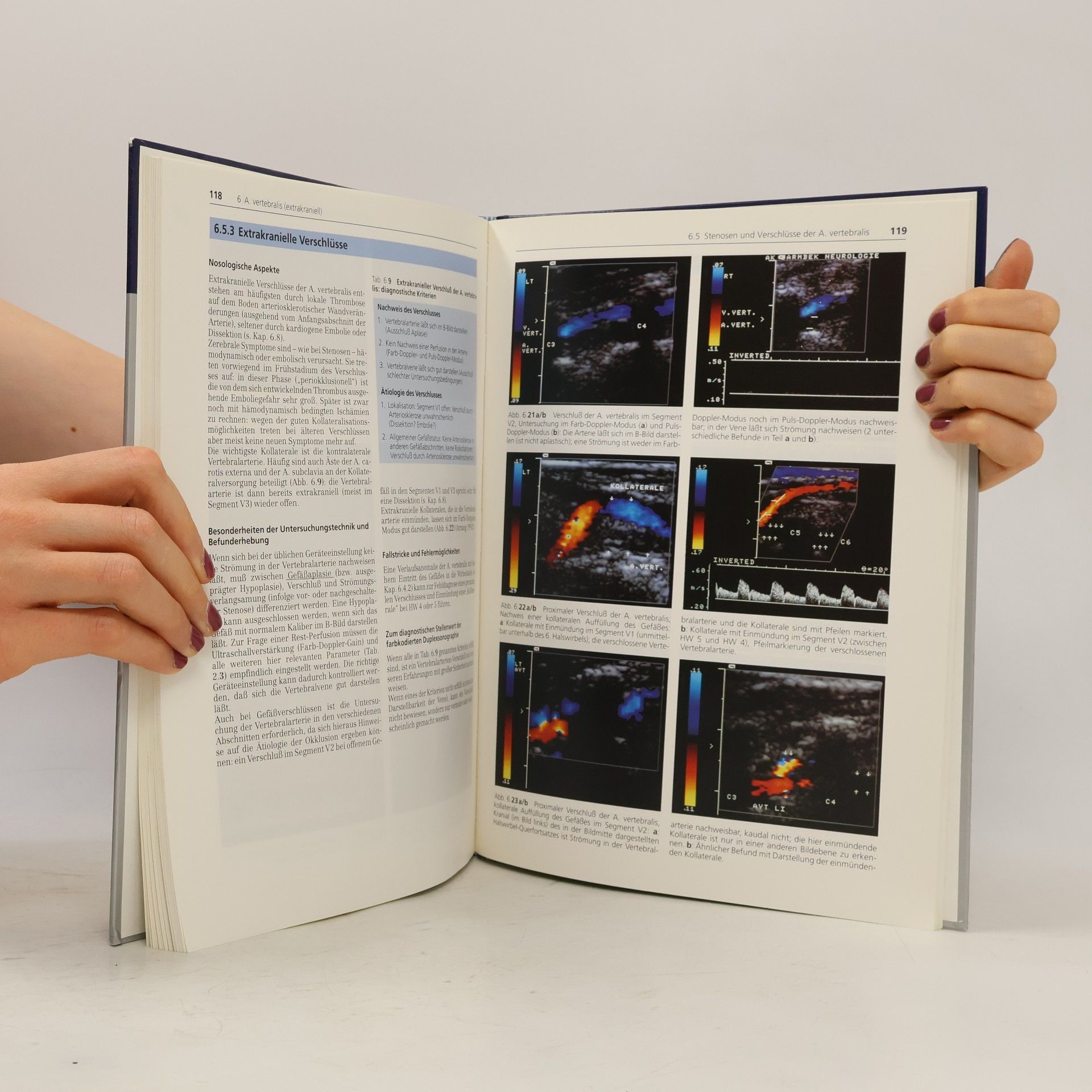 Christian Arning Farbkodierte Duplexsonographie der hirnversorgenden Arterien
