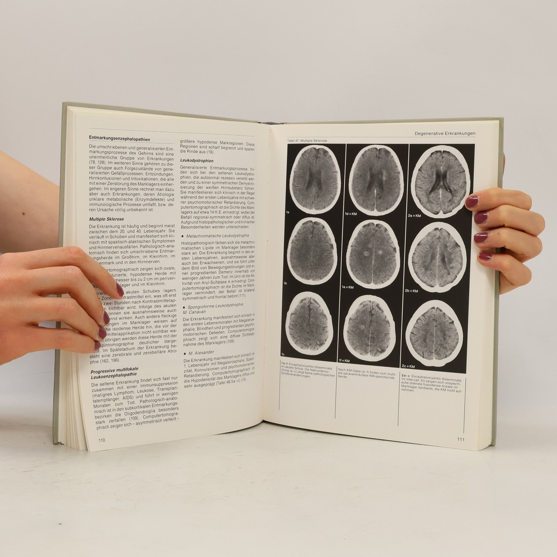 Sebastian Lange Zerebrale und spinale Computertomographie