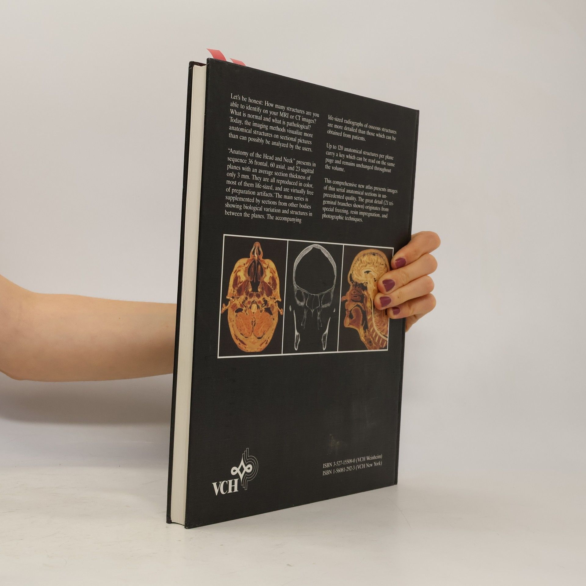 Anatomy of the Head and Neck: A Multiplanar Atlas for Radiologists and Surgeons