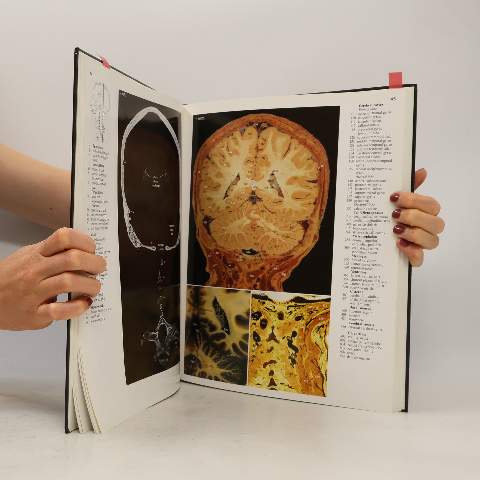 Anatomy of the Head and Neck: A Multiplanar Atlas for Radiologists and Surgeons