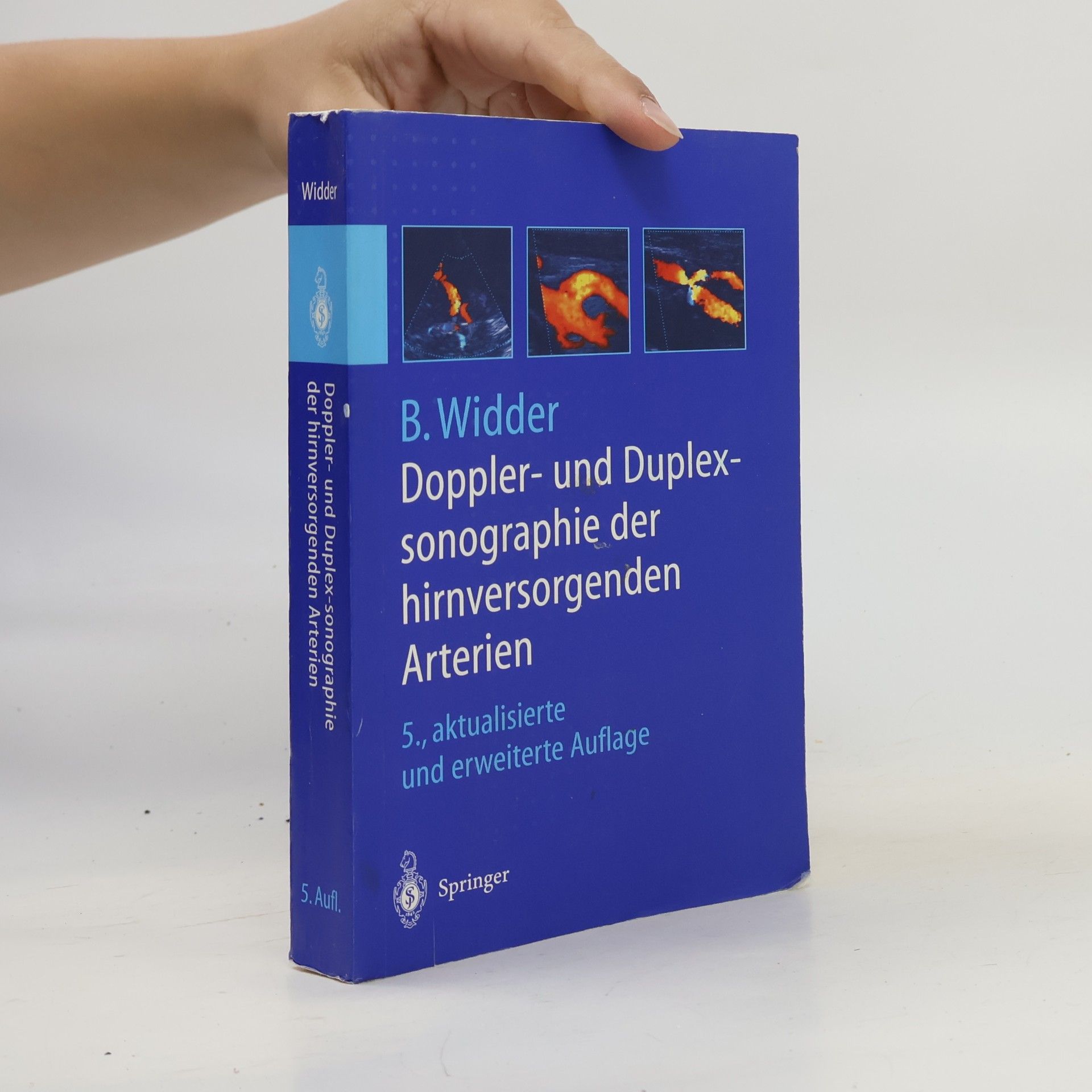 Bernhard Widder Doppler- und Duplexsonographie der hirnversorgenden Arterien