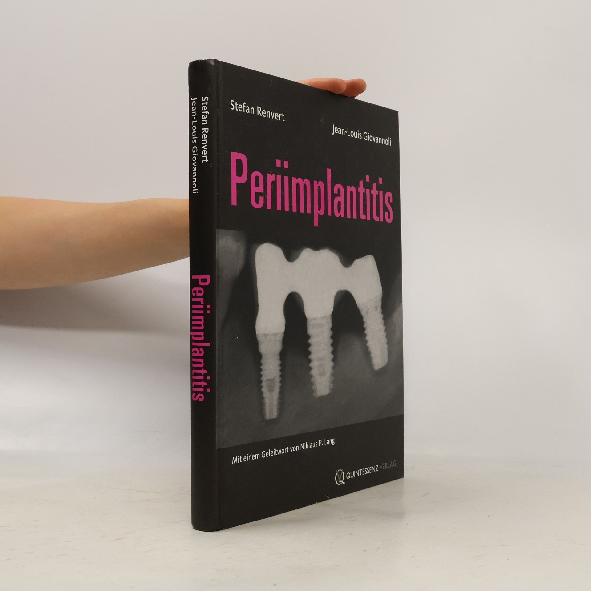 Jean-Louis Giovannoli Periimplantitis