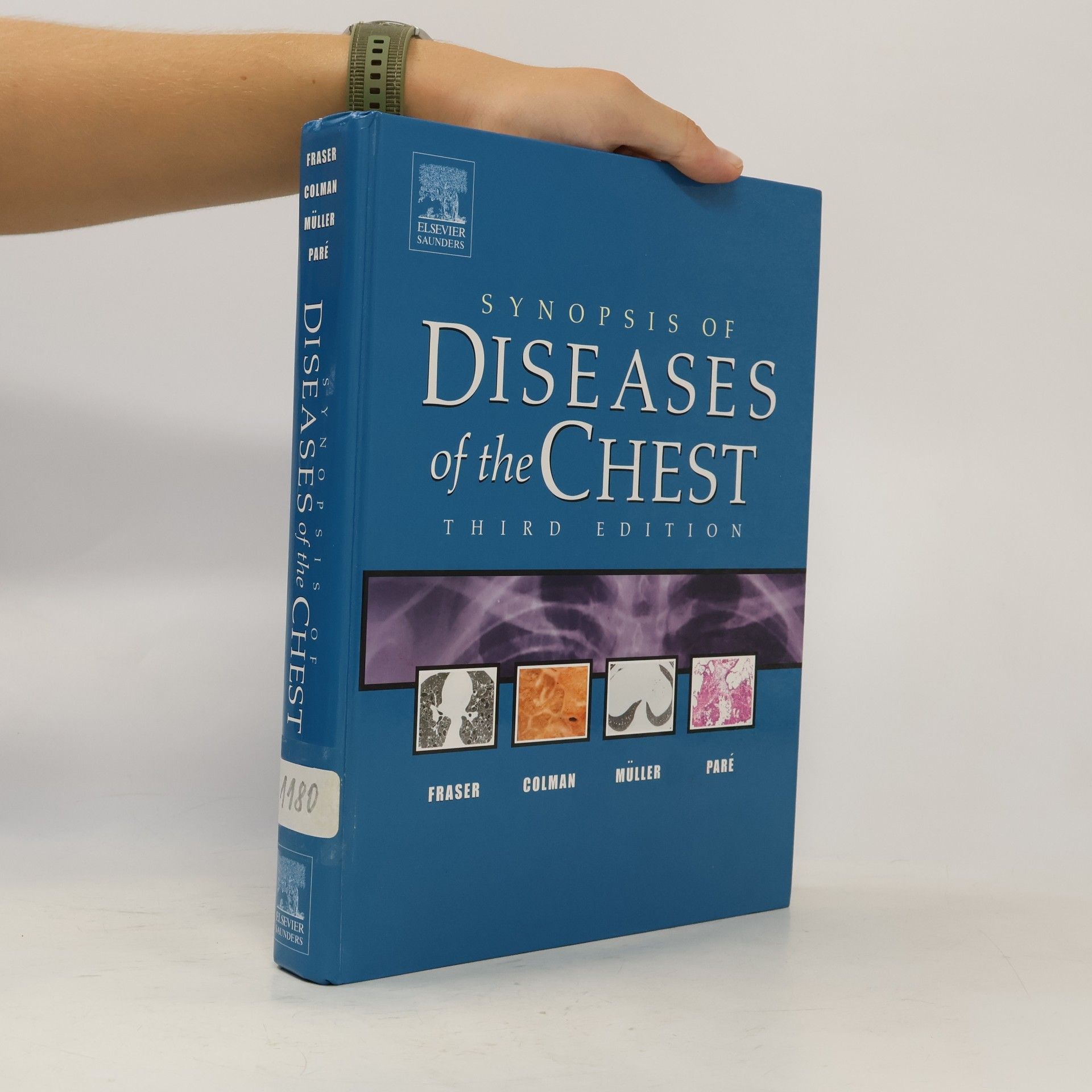 J.A. Peter Paré Synopsis of Diseases of the Chest