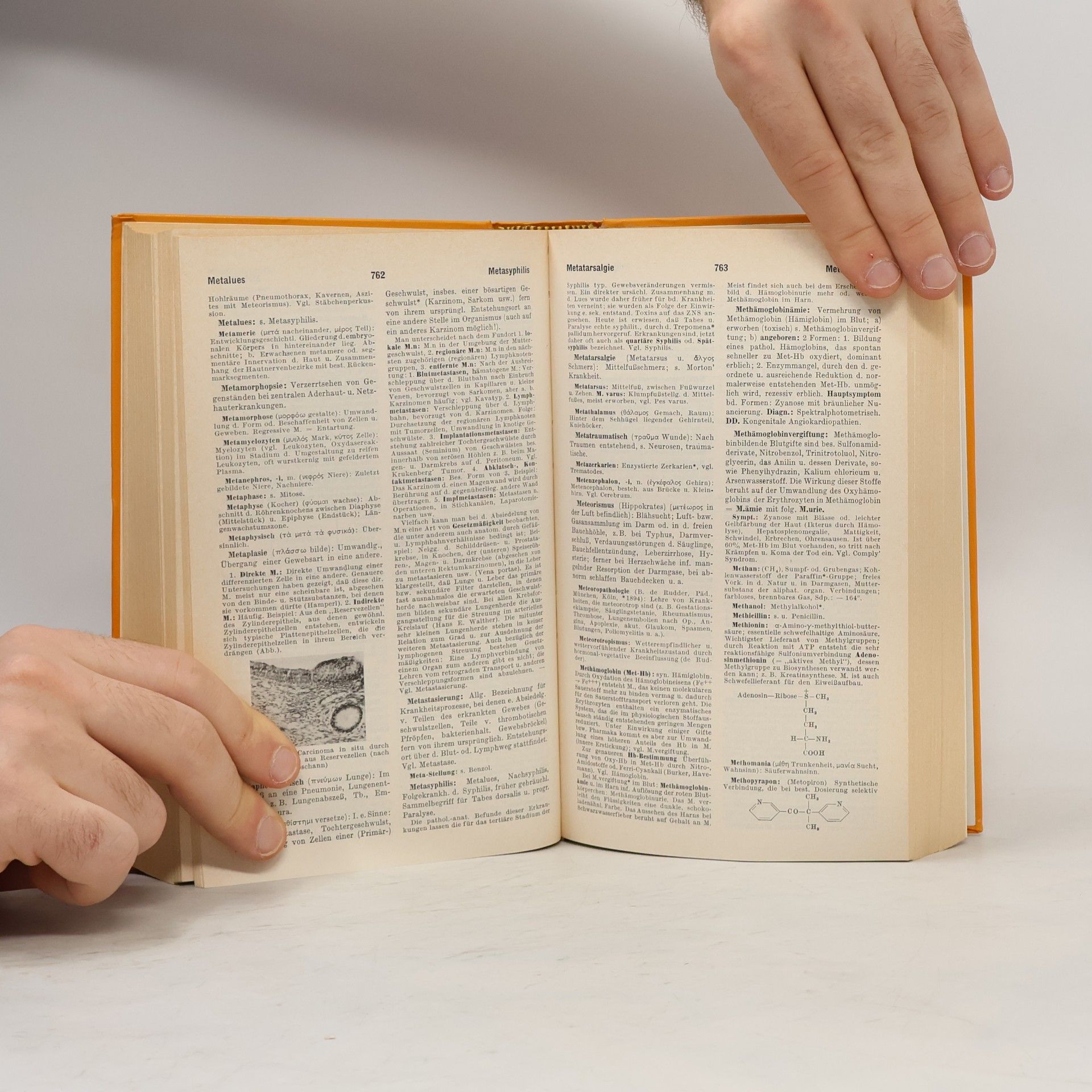 Willibald Pschyrembel Klinisches Wörterbuch