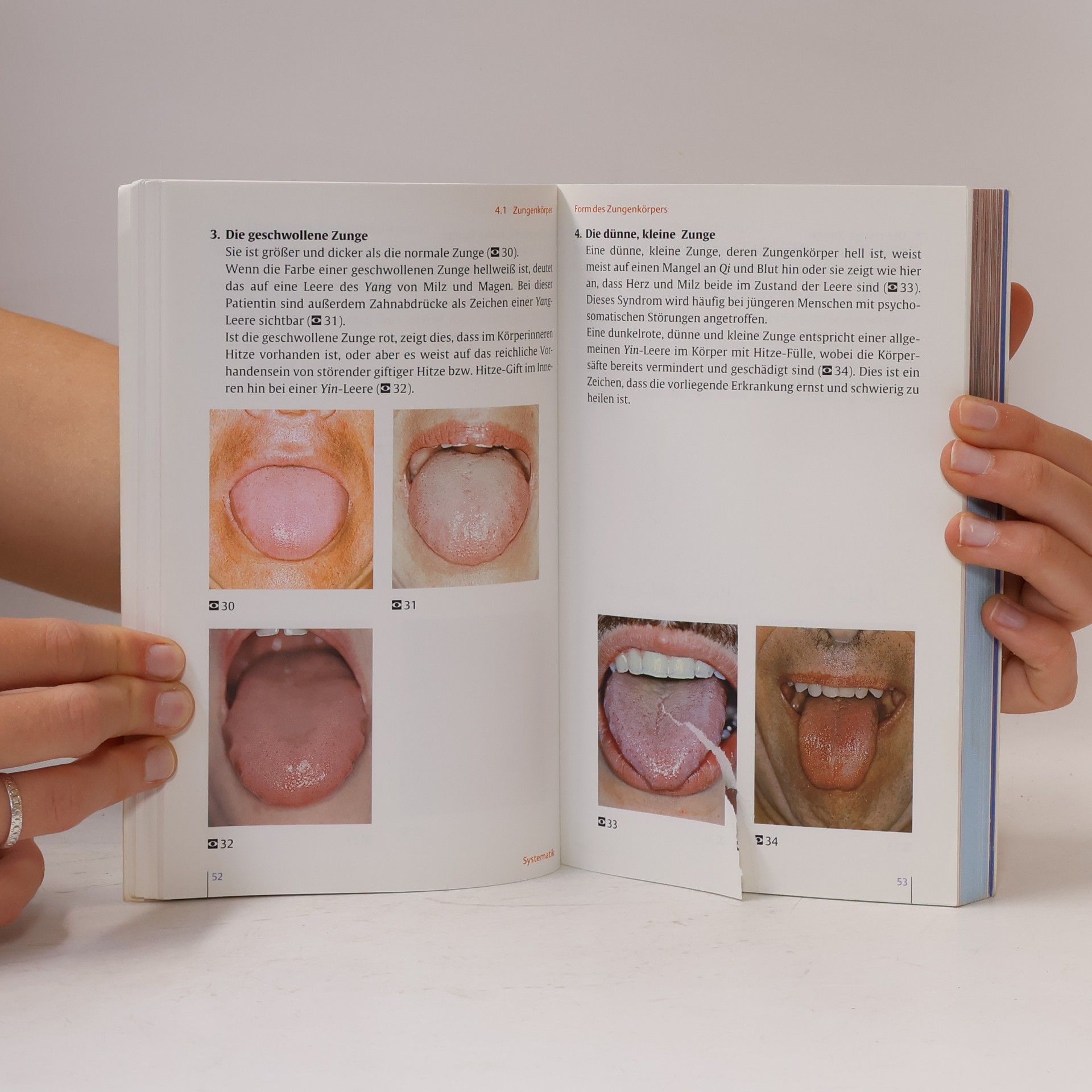 Claus C. Schnorrenberger Taschenatlas der Zungendiagnostik