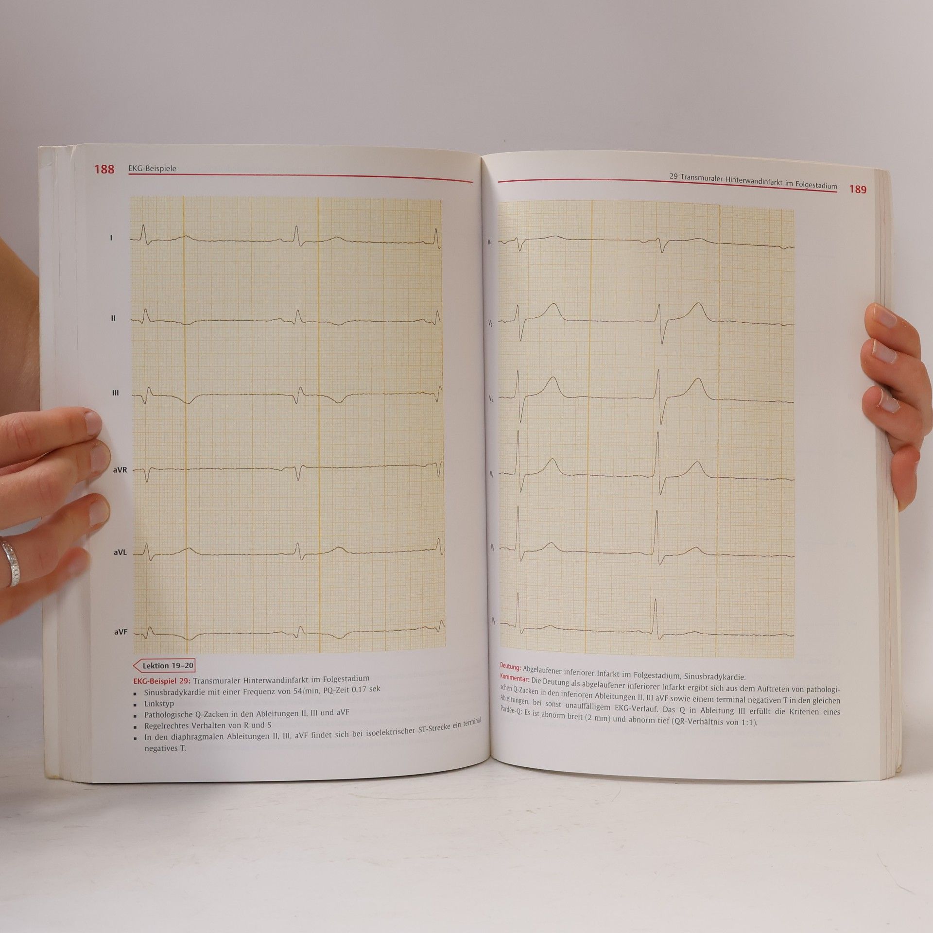 Peter Schuster EKG-Kurs für Isabel