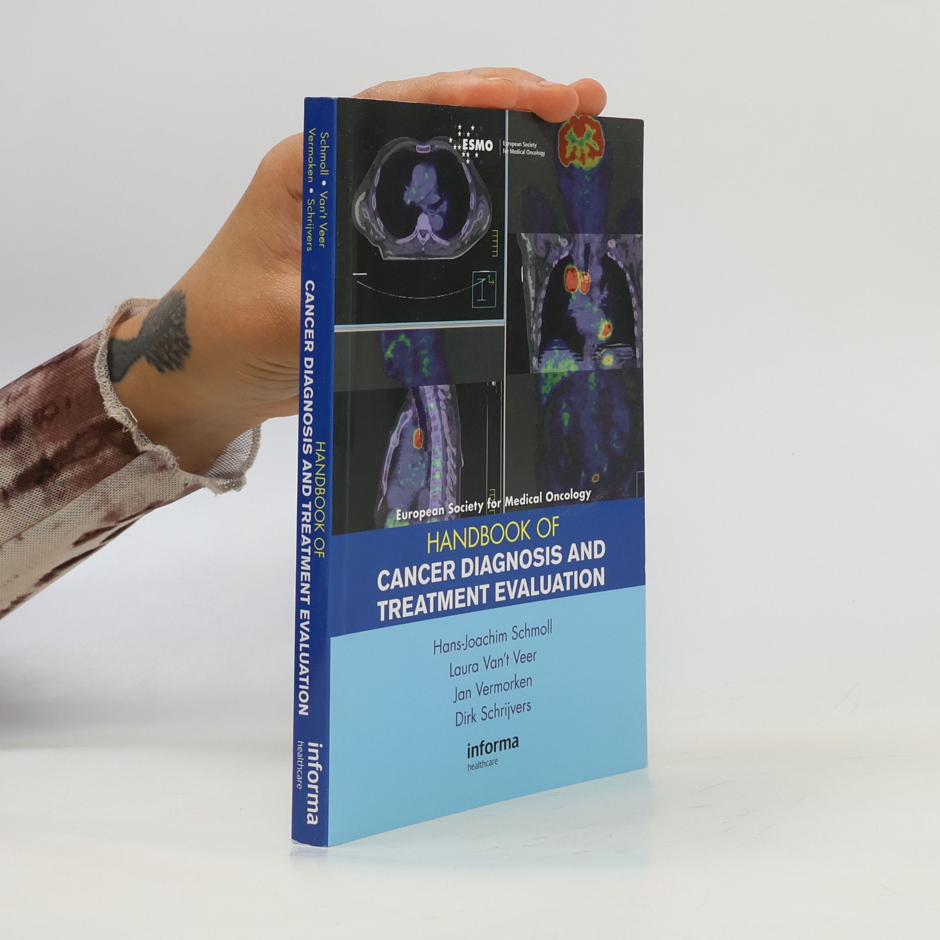 Autorenkollektiv Handbook of Cancer Diagnosis and Treatment Evaluation