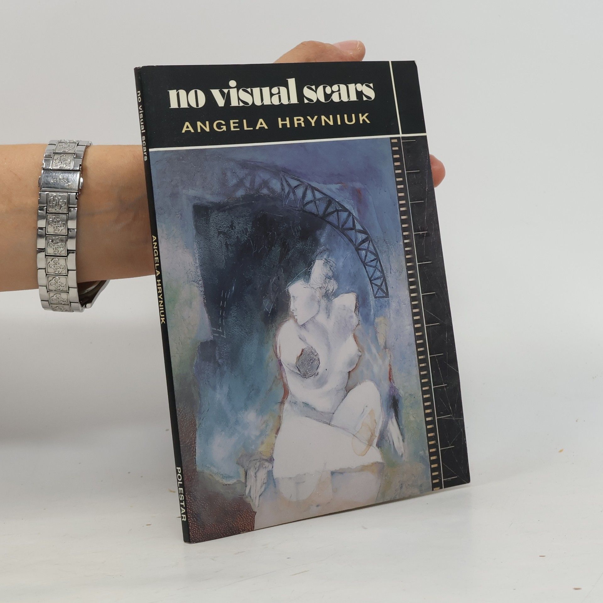Angela Hryniuk No Visual Scars
