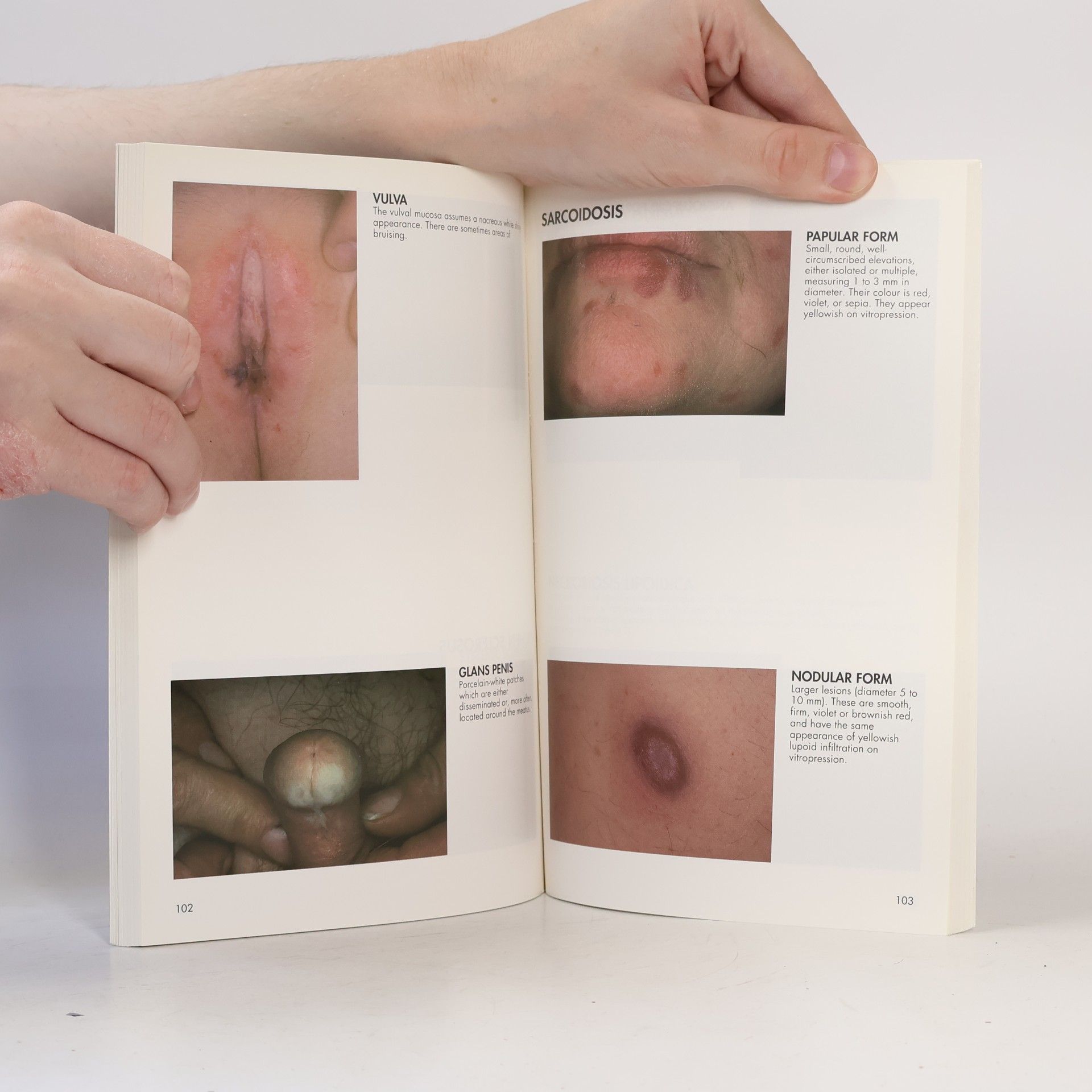 Jean Marie Lachapelle Atlas on Dermatology