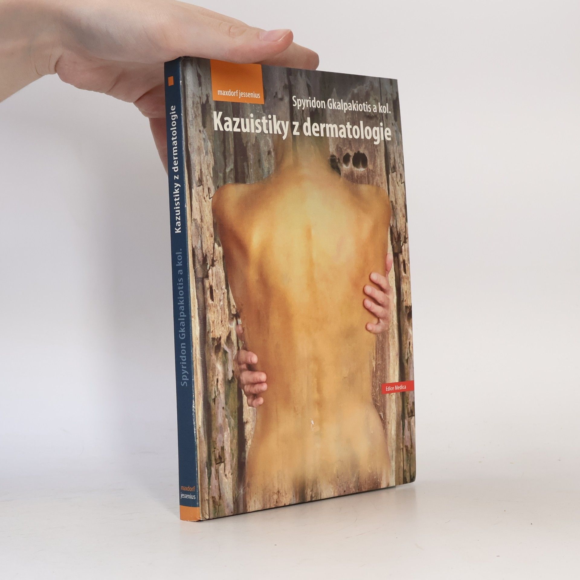 Spyridon Gkalpakiotis Kazuistiky z dermatologie