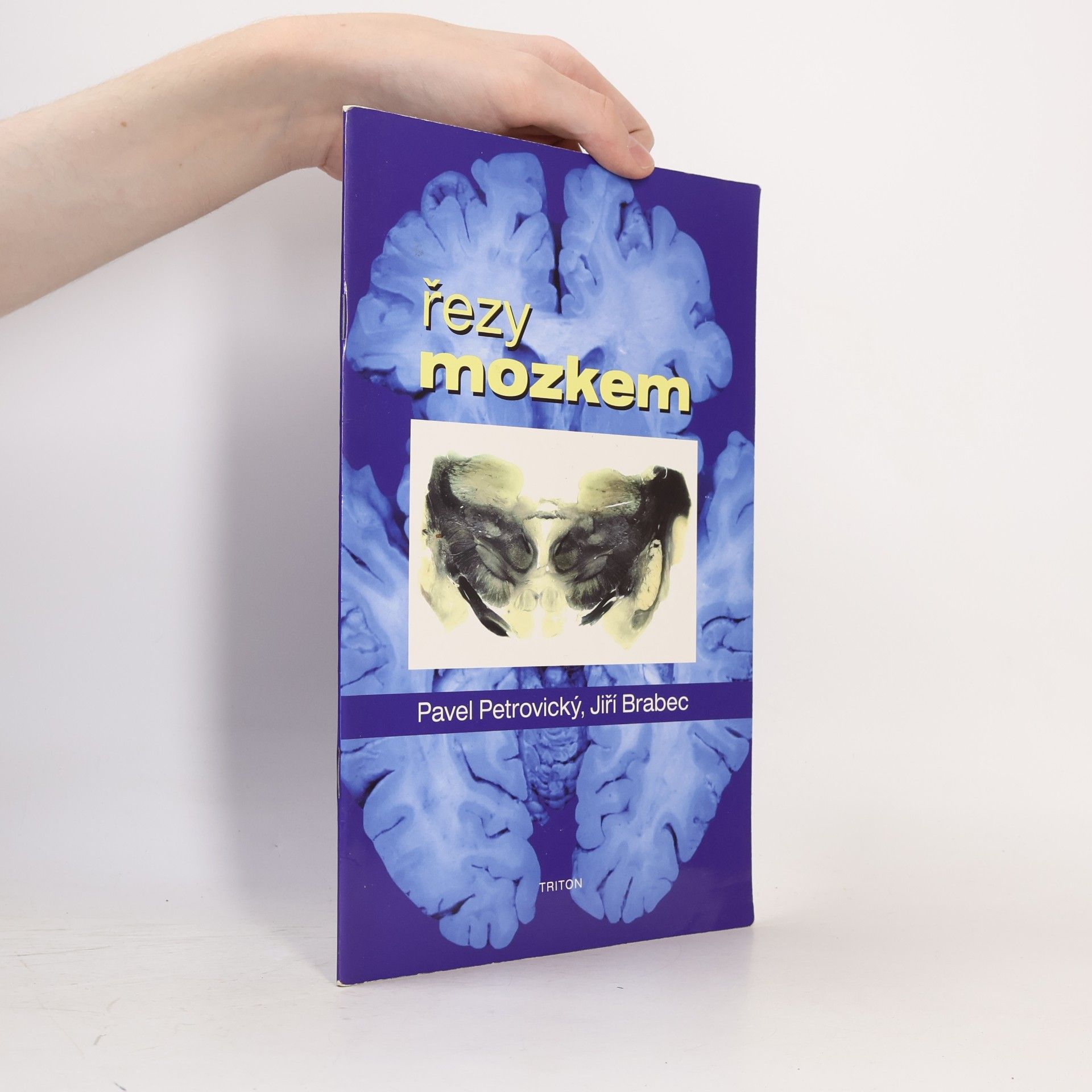 Jiří Brabec Řezy mozkem