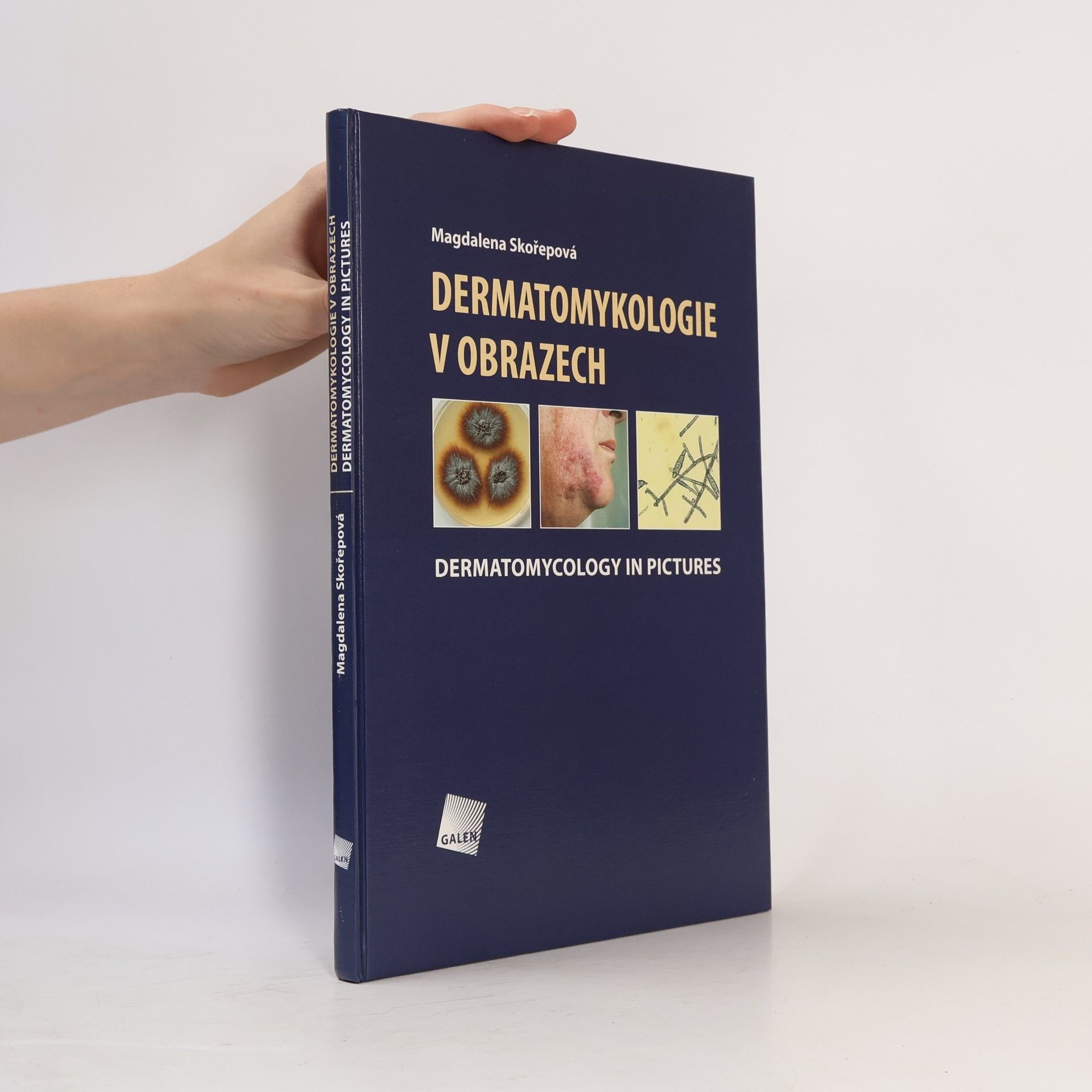 Magdalena Skořepová Dermatomykologie v obrazech