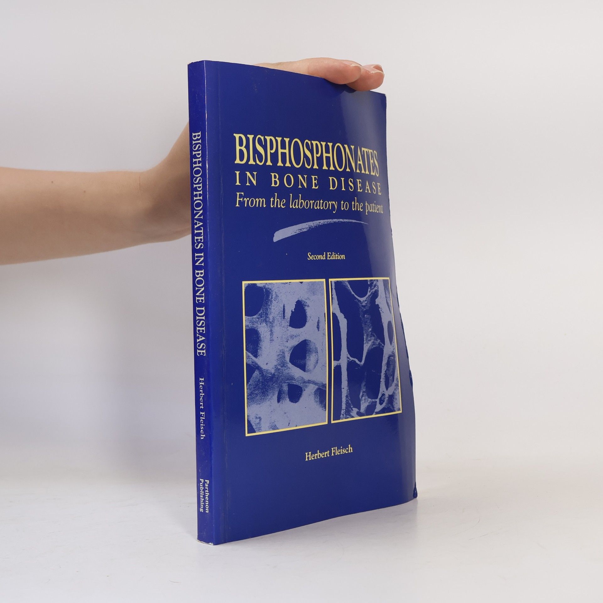Herbert Fleisch Bisphosphonates in Bone Disease