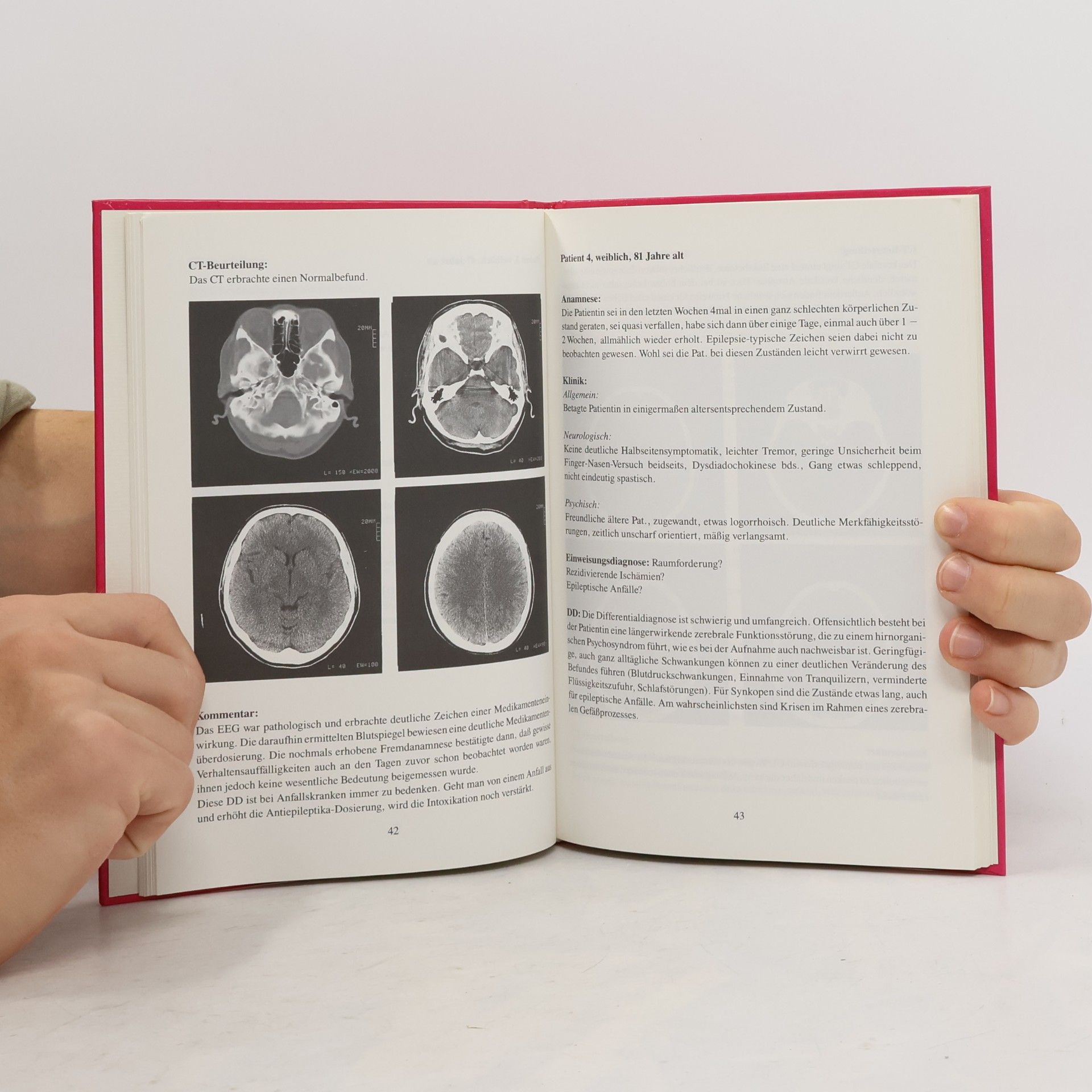 Bernhard Kügelgen Das hirnorganische Psychosyndrom