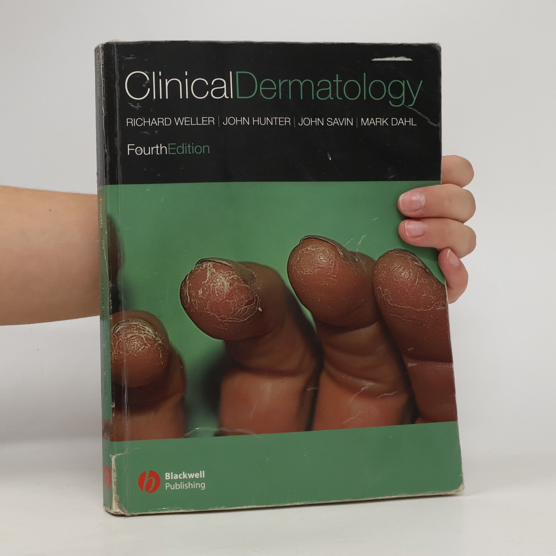 Hamish J. A. Hunter Clinical dermatology