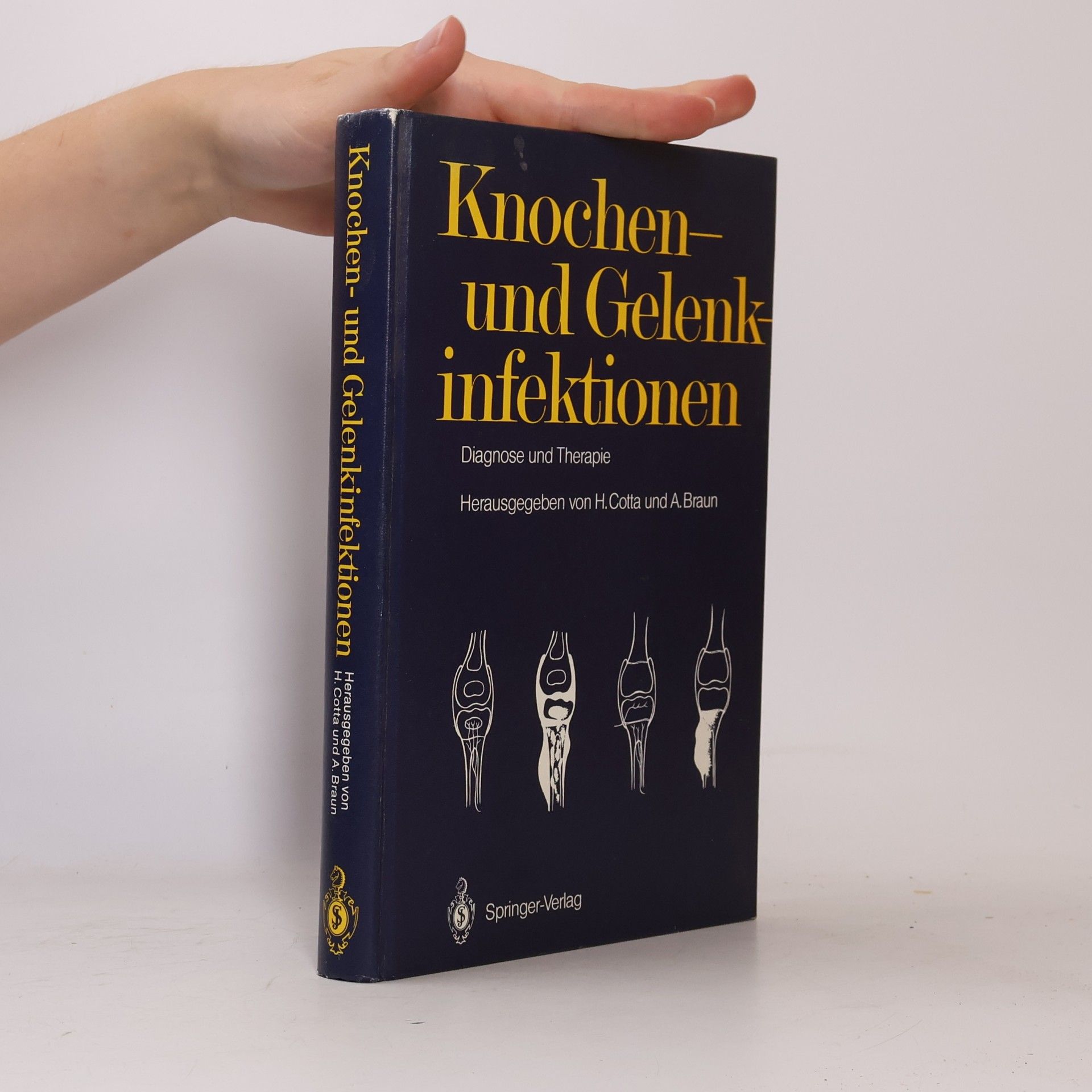 Knochen- und Gelenkinfektionen