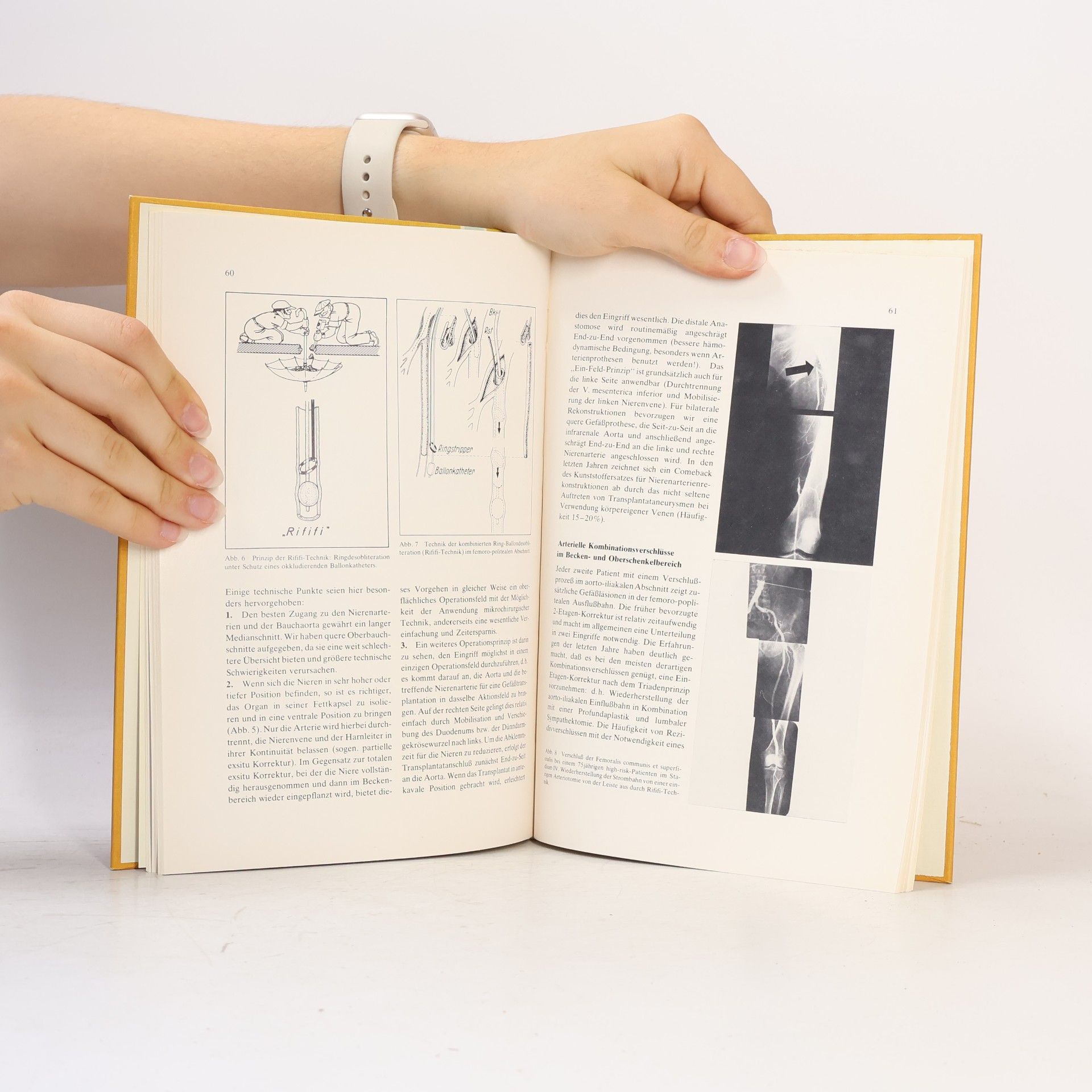 Autorenkollektiv Gefäß-Chirurgie aktuell 1978